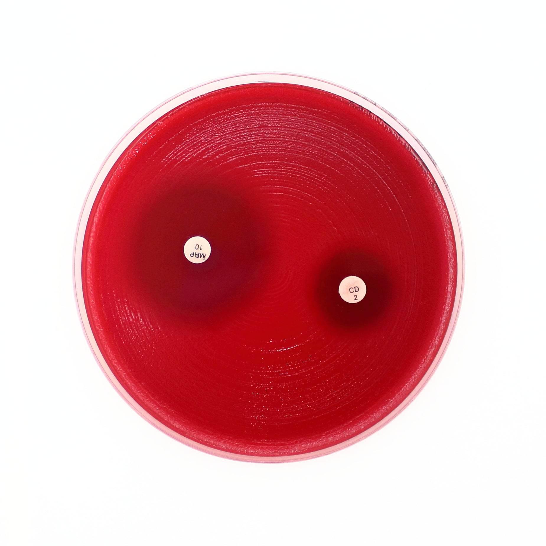 How Lab Data Shapes the Search for Effective, Targeted Antibiotics - Kormay Biomedicals store