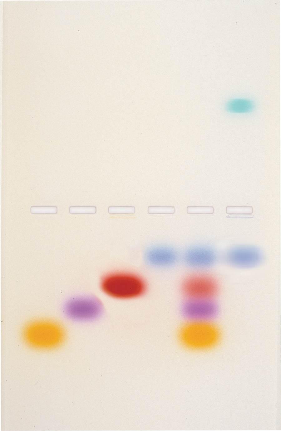 Principles and Practice of Agarose Gel Electrophoresis - Kormay Biomedicals store