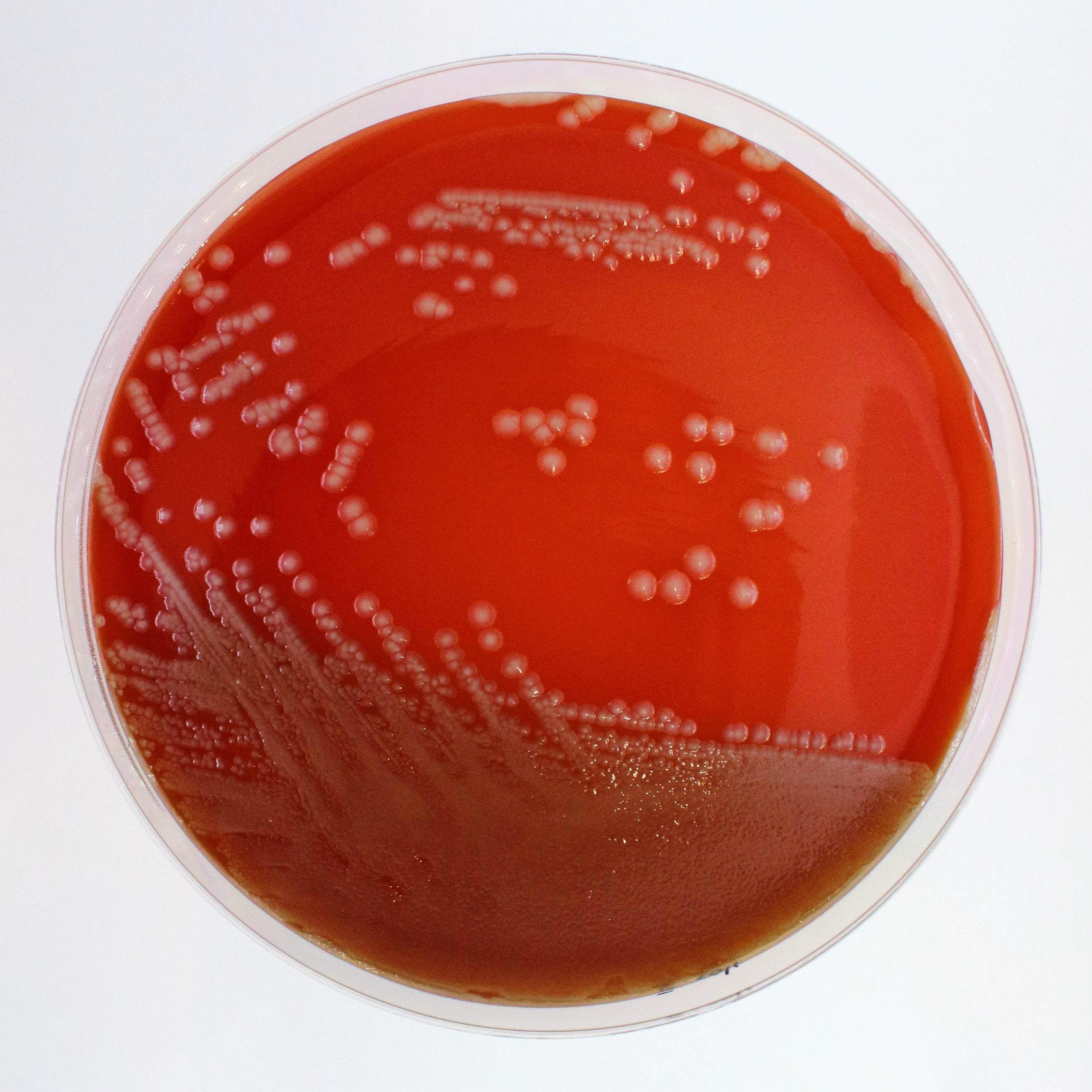 Columbia Agar (Sheep Blood 5%) - Kormay Biomedicals store