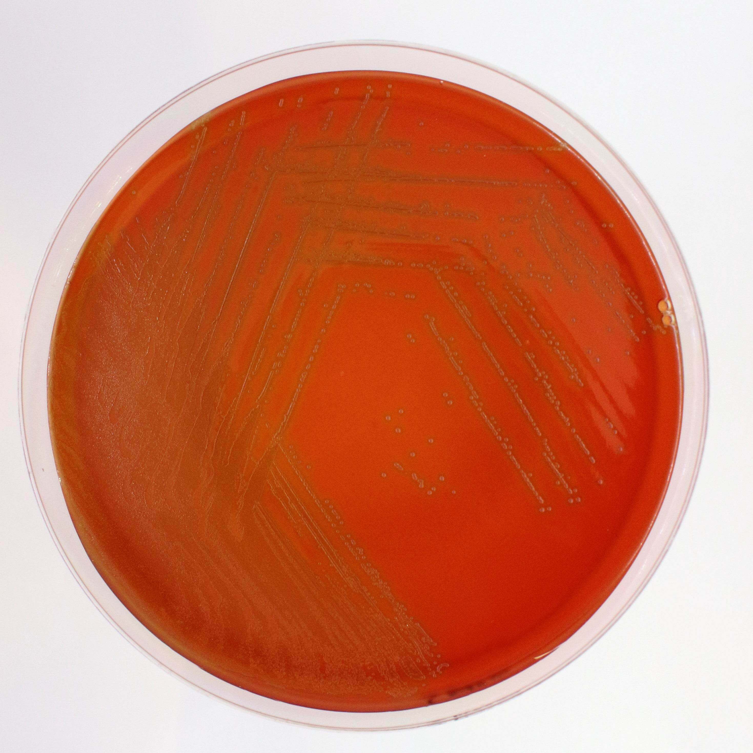 Columbia Agar (Sheep Blood 5%) - Kormay Biomedicals store