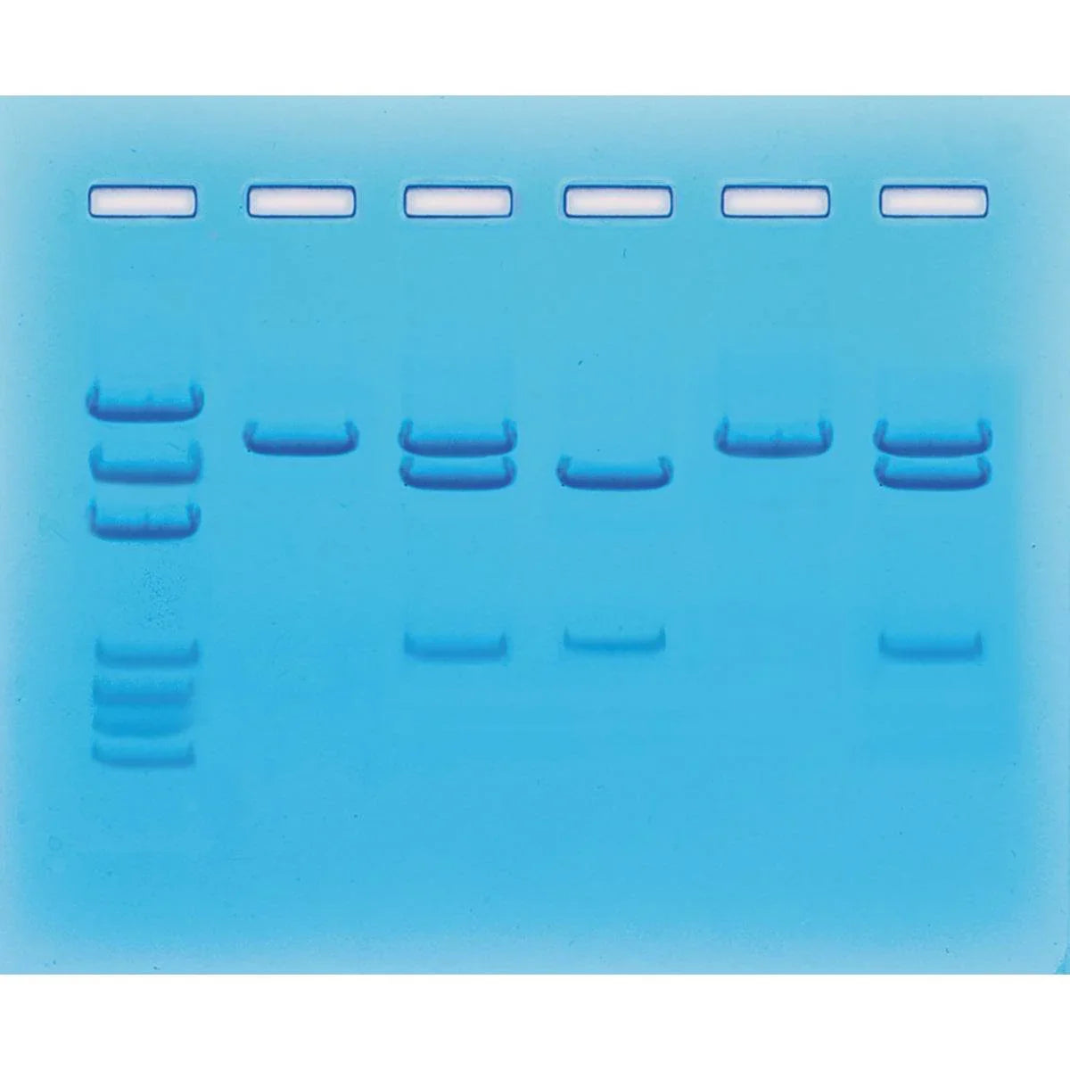 Nucleic Acid Testing for COVID-19 - Kormay Biomedicals store