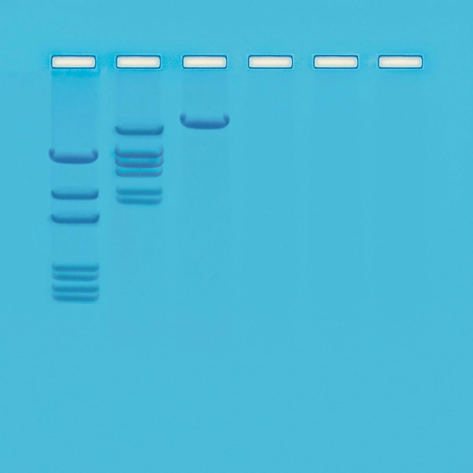 Cleavage of Lambda DNA with Eco RI Restriction Enzyme - Kormay Biomedicals store
