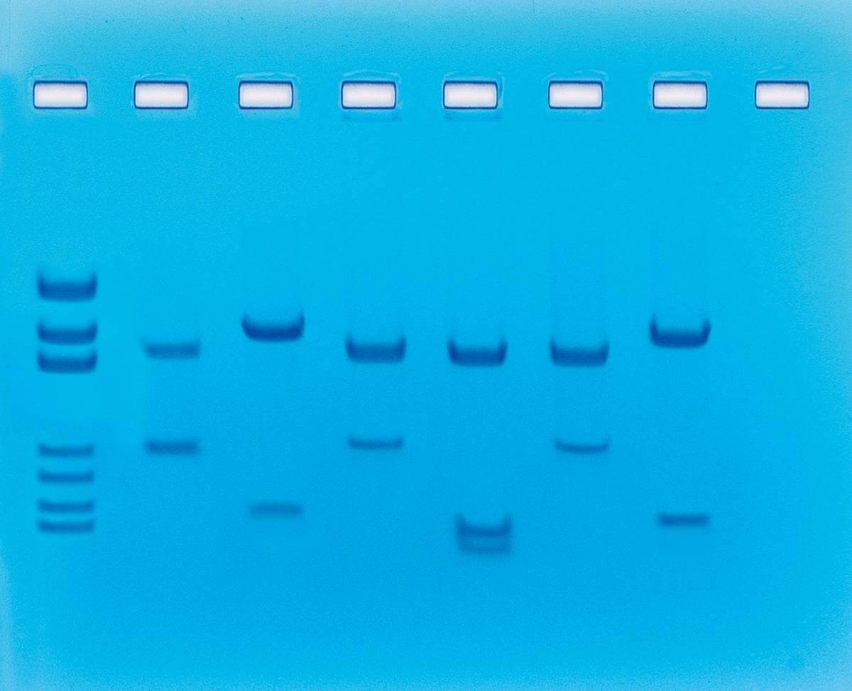 DNA Fingerprinting - Using Restriction Enzymes - Kormay Biomedicals store