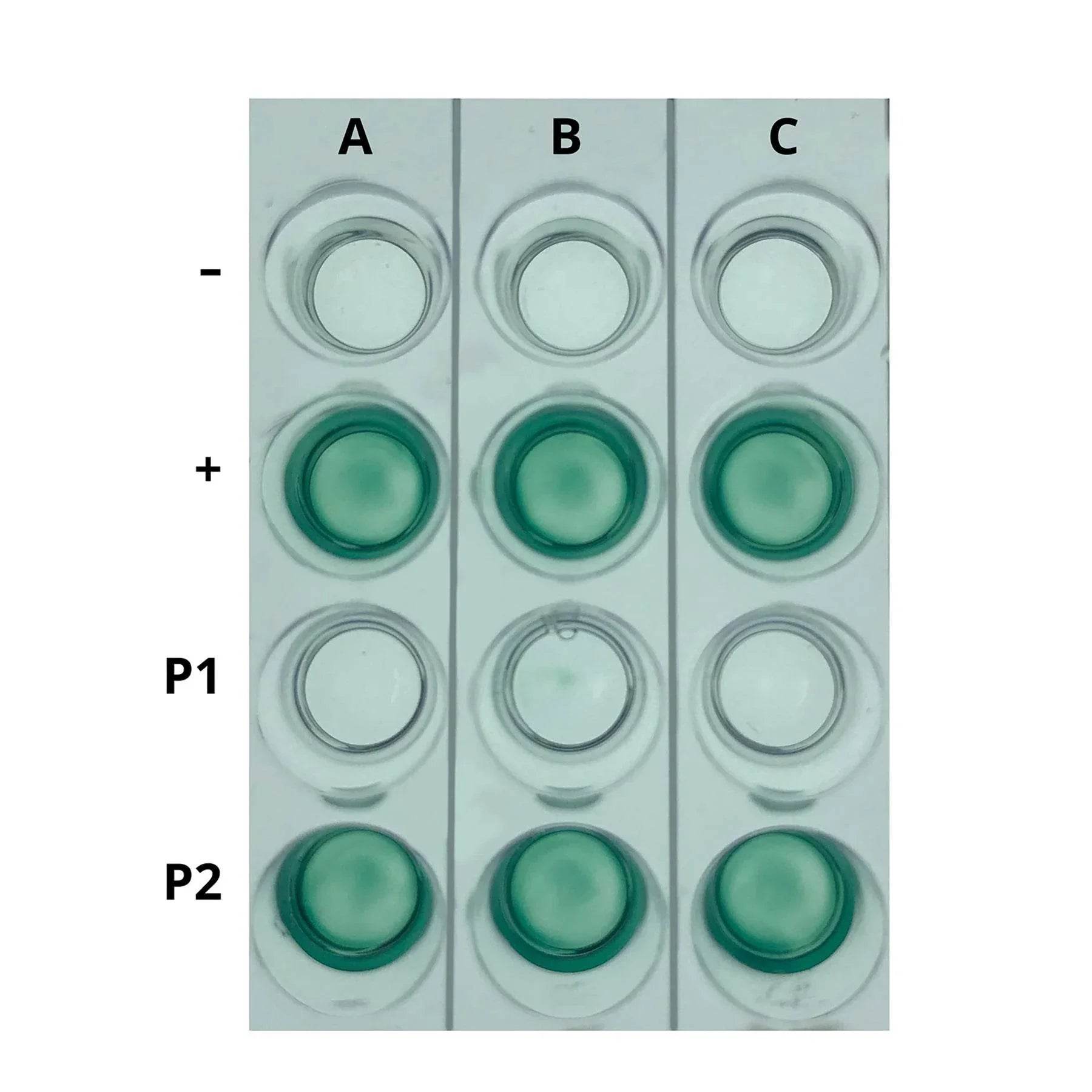 AIDS Kit I: Simulation of HIV Detection by ELISA - Kormay Biomedicals store