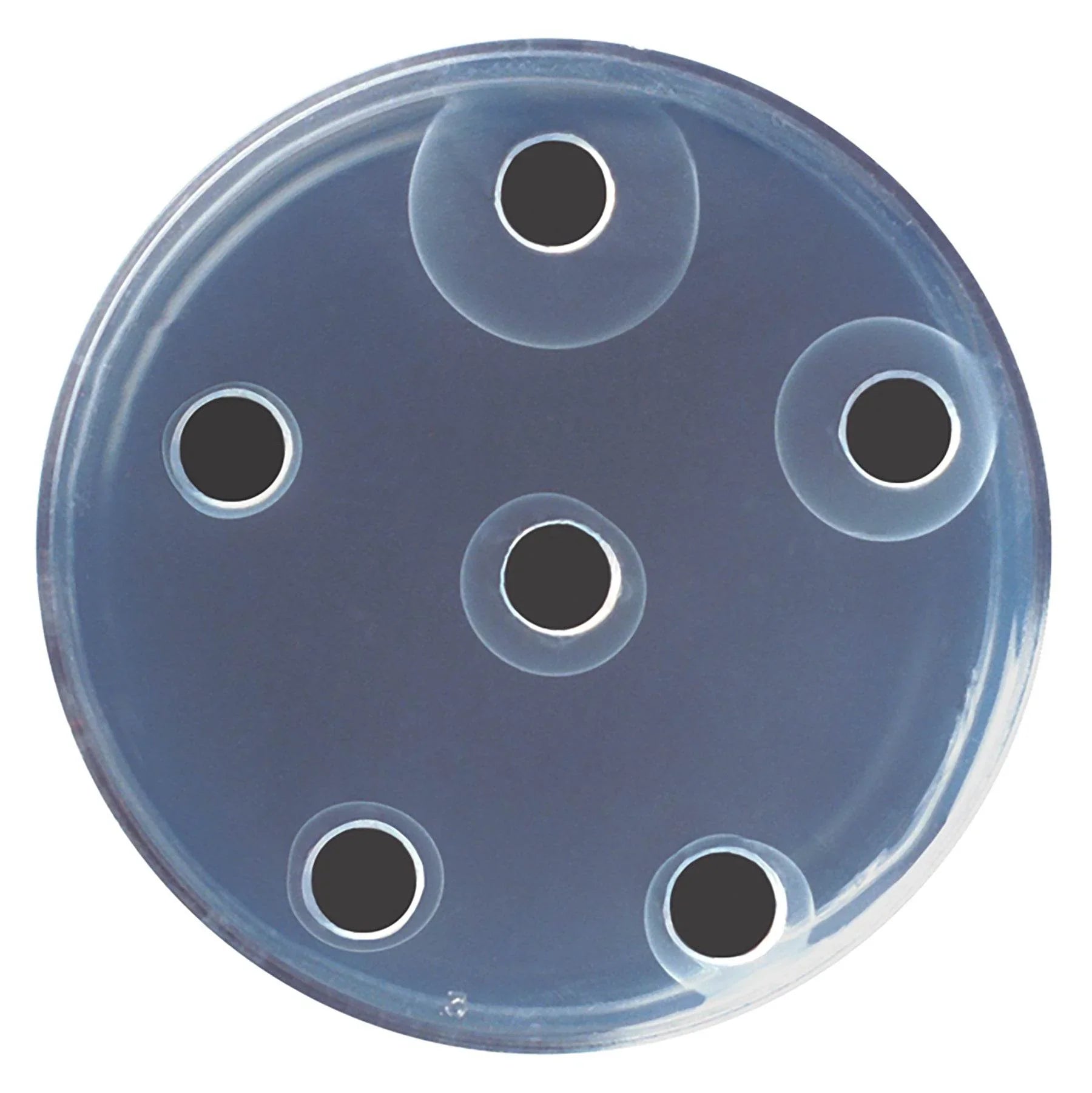 Radial Immunodiffusion - Kormay Biomedicals store