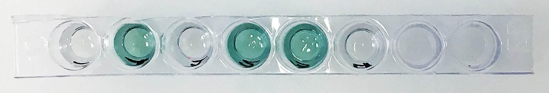 Identifying the Epstein Barr Virus Using ELISA - Kormay Biomedicals store