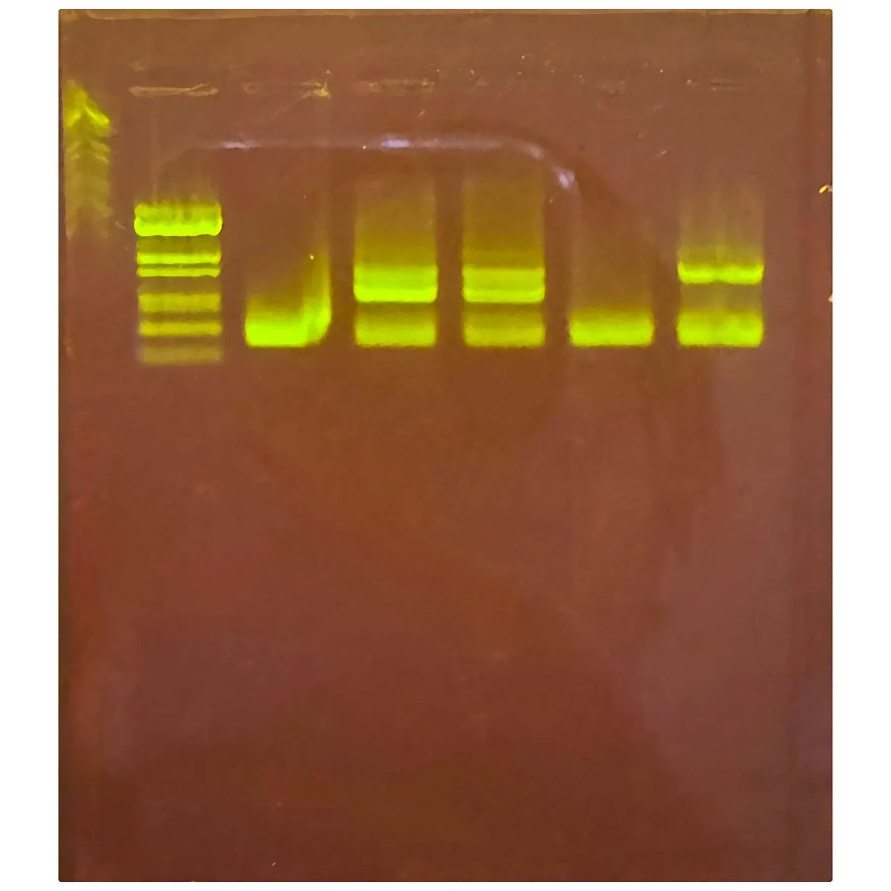 Detecting COVID-19 Using Reverse-Transcription PCR (RT-PCR) - Kormay Biomedicals store