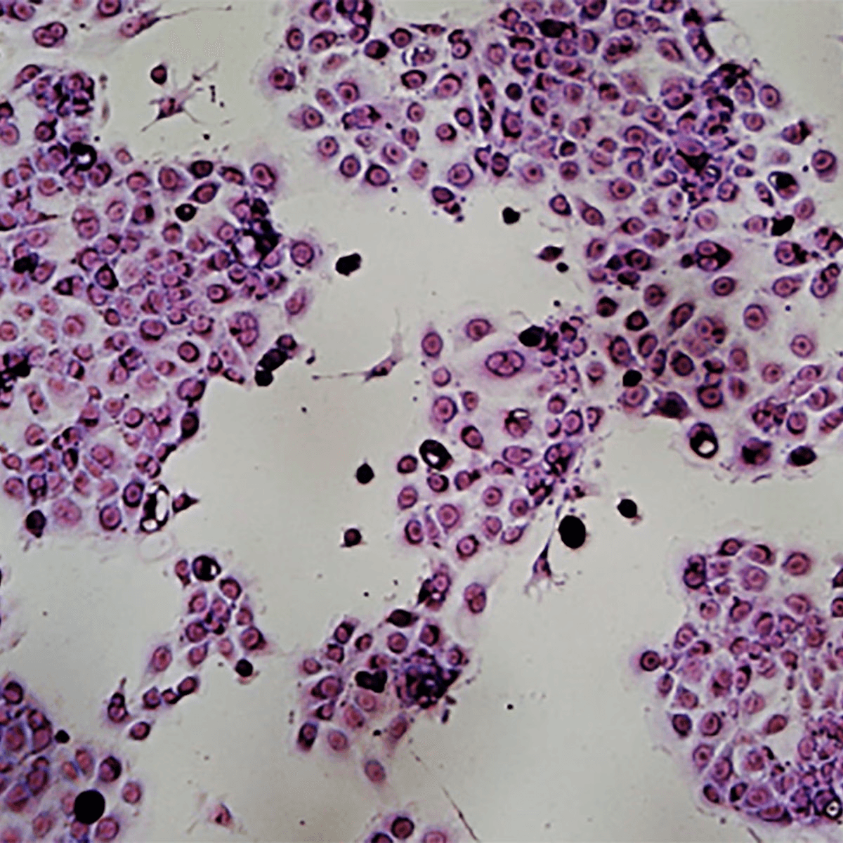 Morphology of Cancer Cells - Kormay Biomedicals store