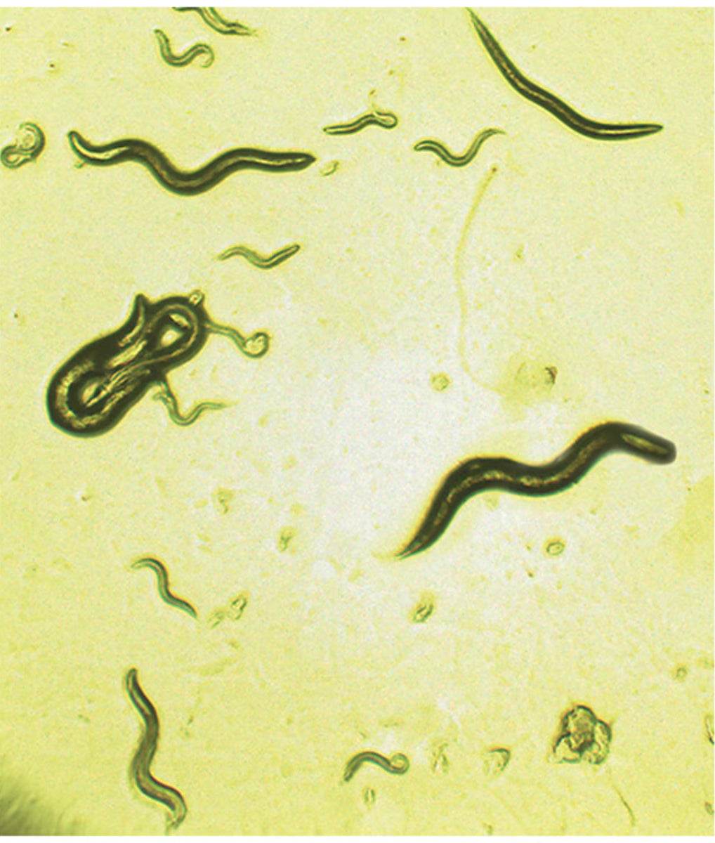 Effects of Alcohol on c. elegans - Kormay Biomedicals store