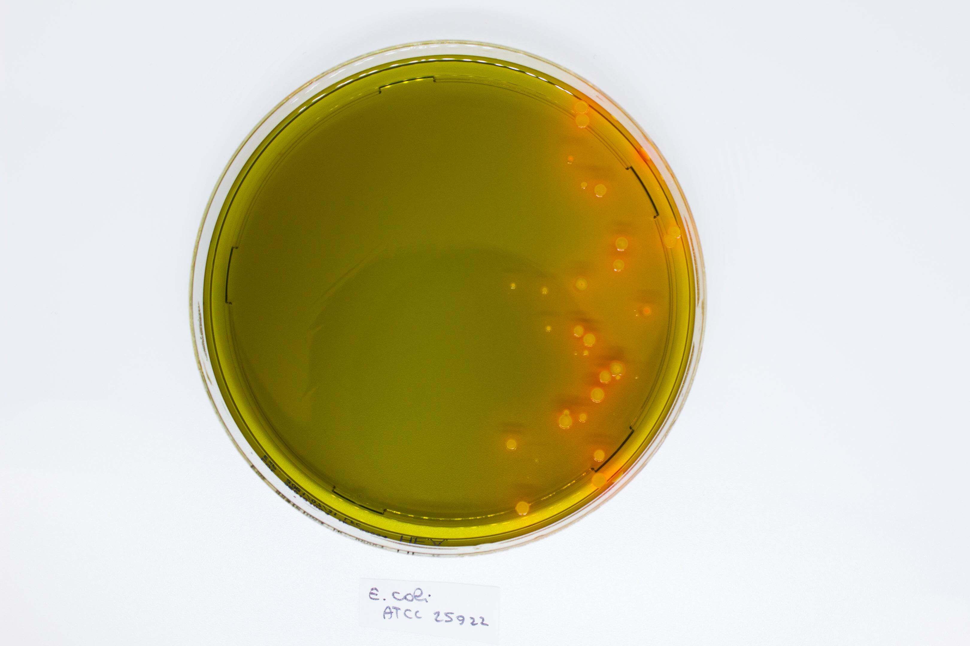 Hektoen Enteric Agar - Kormay Biomedicals store