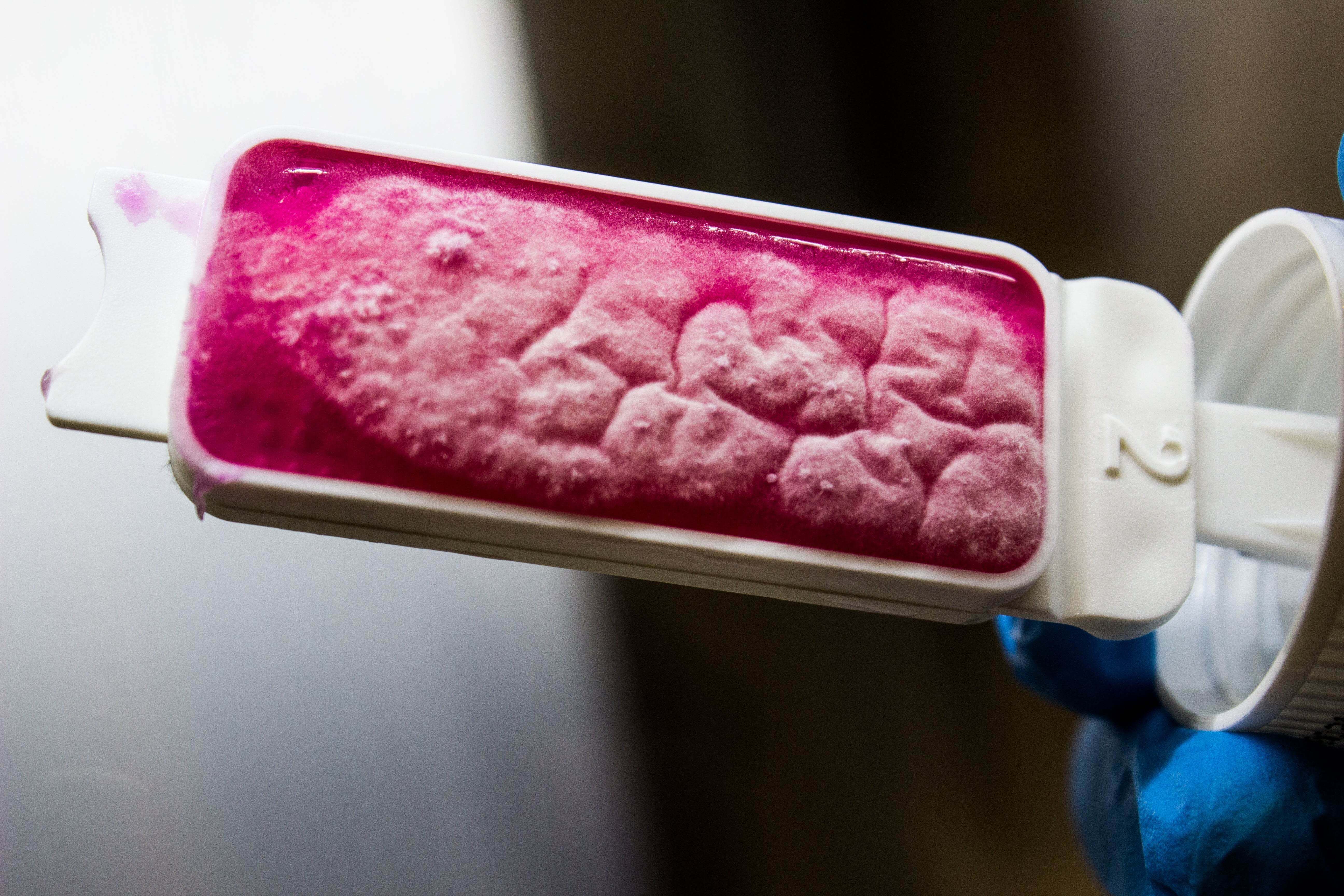 Contact Slide TSA + NEUTR./ ROSE Bengal - Kormay Biomedicals store