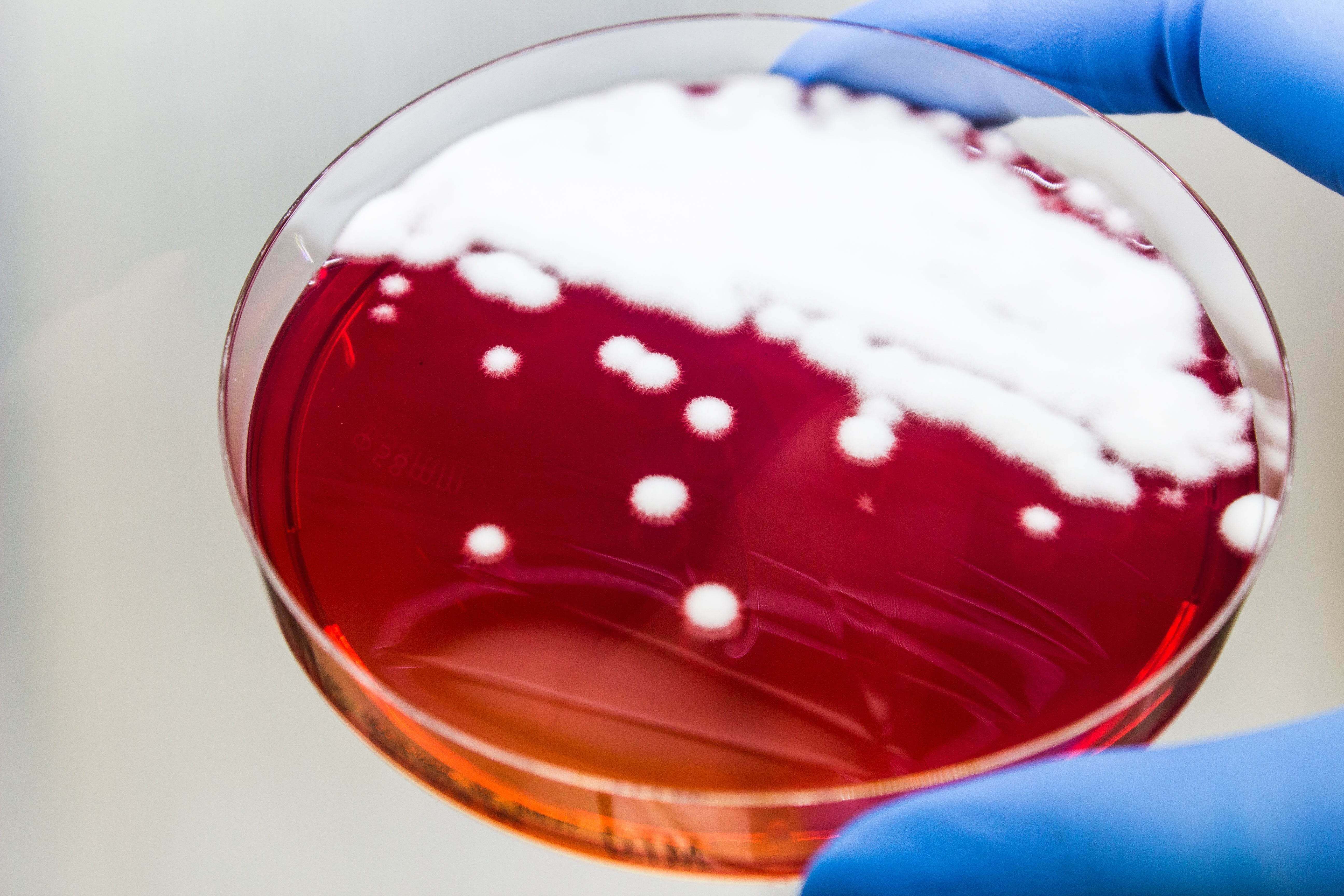 DERMATOPHYTE (D.T.M.) Agar - Kormay Biomedicals store