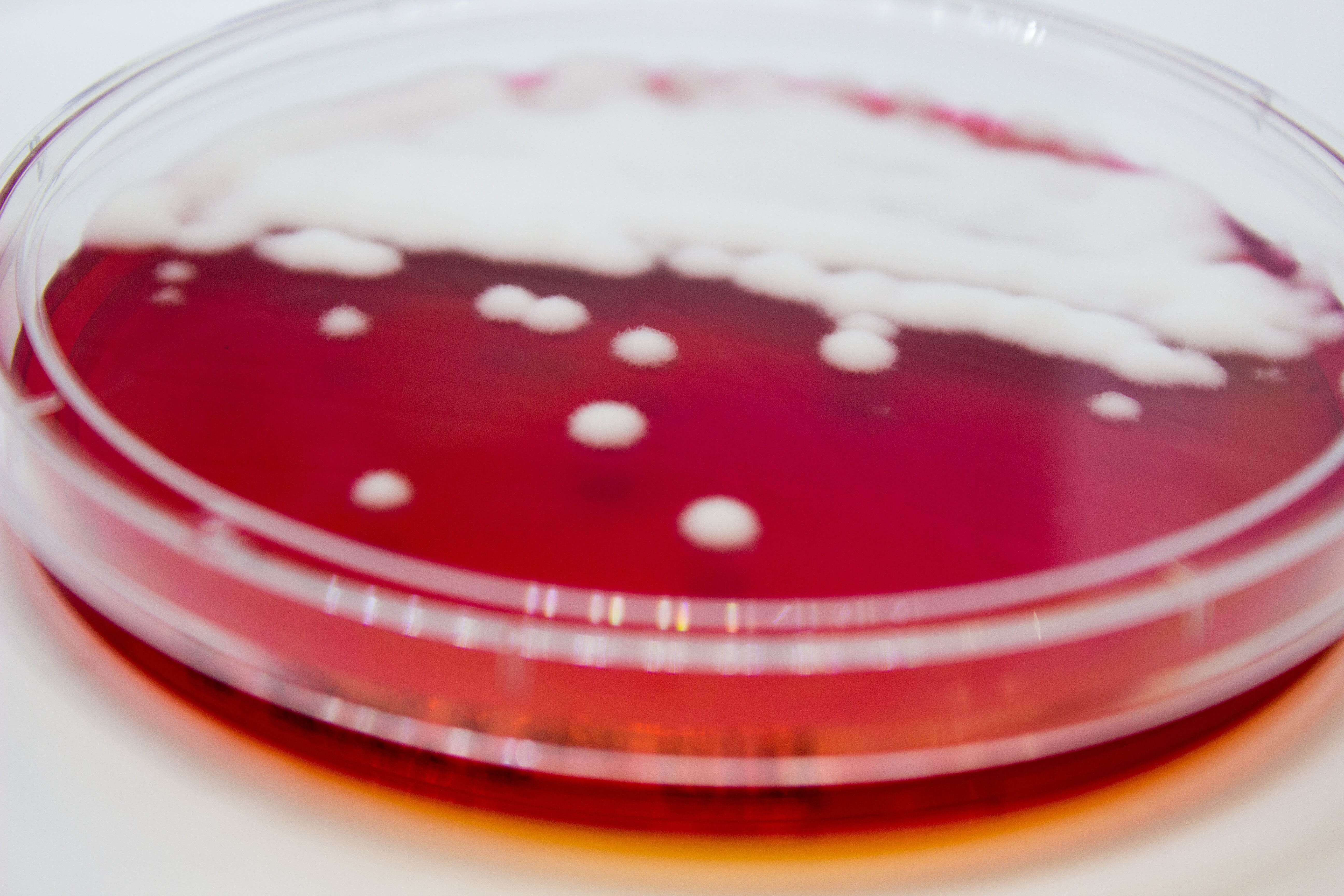 DERMATOPHYTE (D.T.M.) Agar - Kormay Biomedicals store