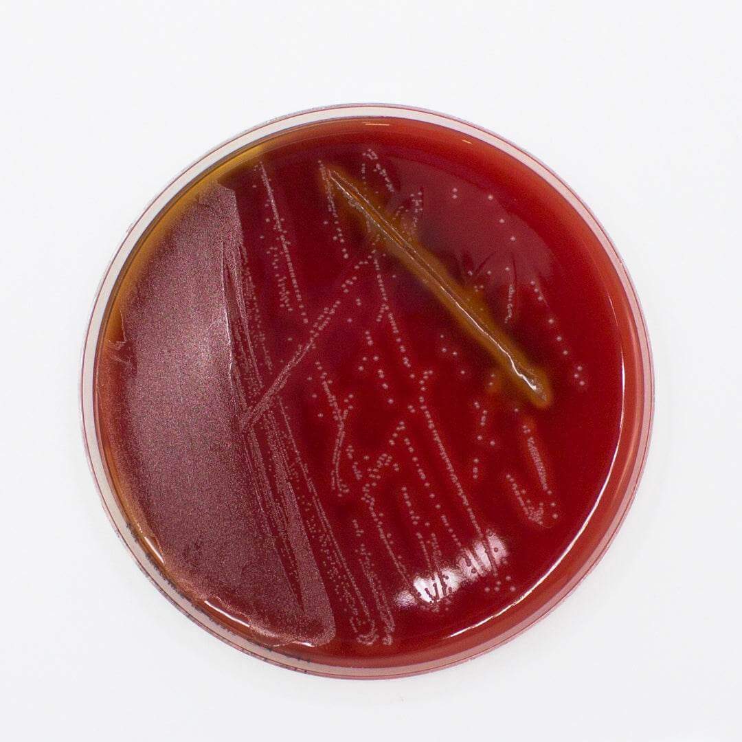 Columbia Agar (Horse Blood 5%) - Kormay Biomedicals store