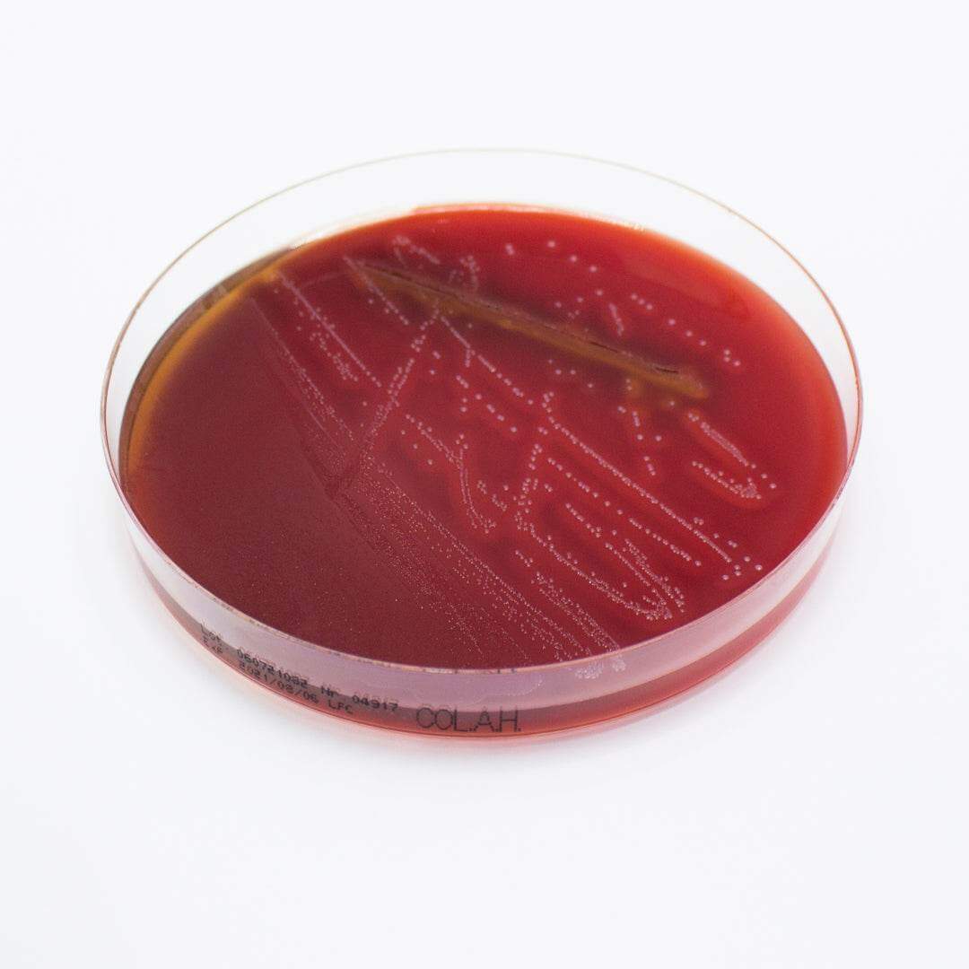 Columbia Agar (Horse Blood 5%) - Kormay Biomedicals store