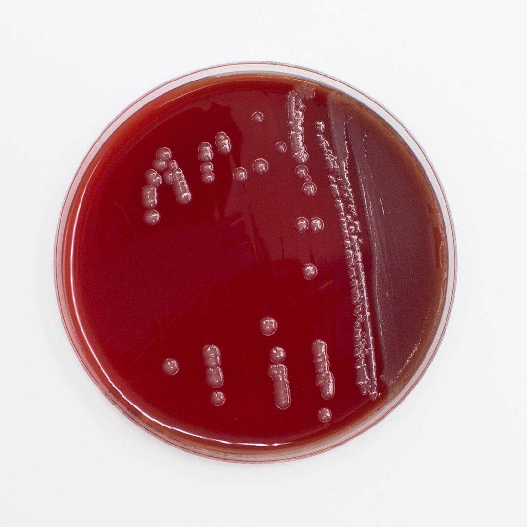 Columbia Agar (Horse Blood 5%) - Kormay Biomedicals store
