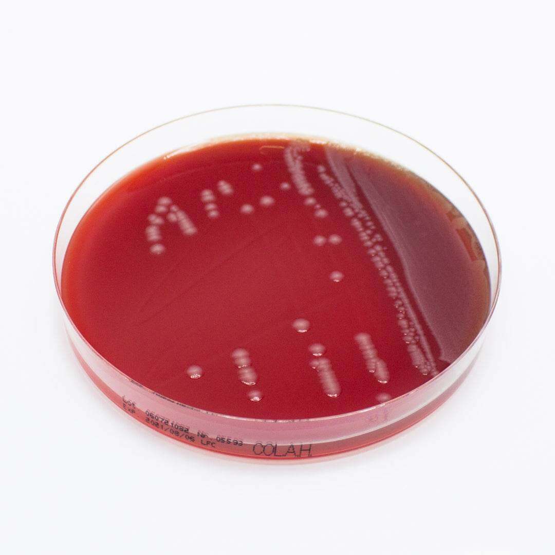 Columbia Agar (Horse Blood 5%) - Kormay Biomedicals store