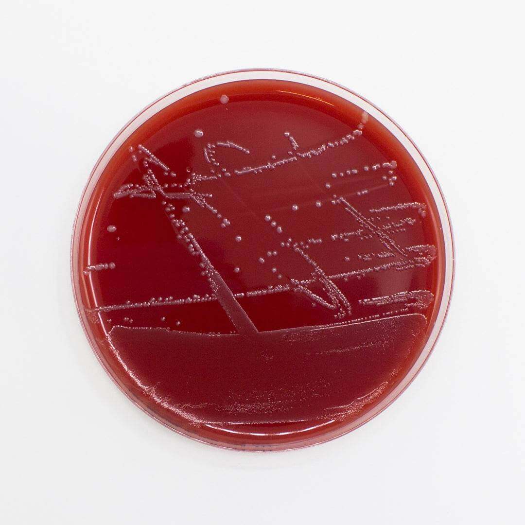 Columbia Agar (Horse Blood 5%) - Kormay Biomedicals store