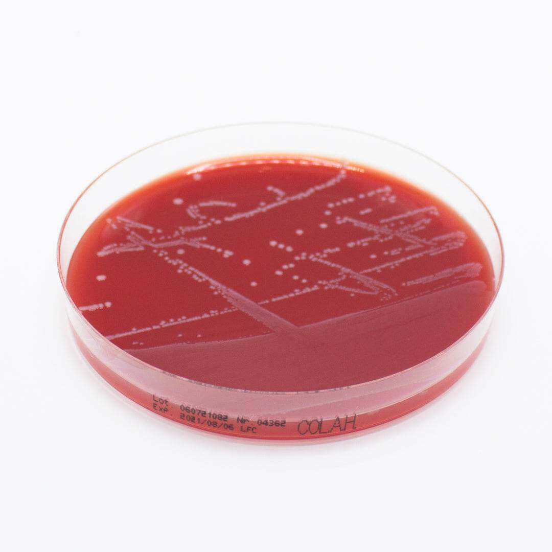 Columbia Agar (Horse Blood 5%) - Kormay Biomedicals store