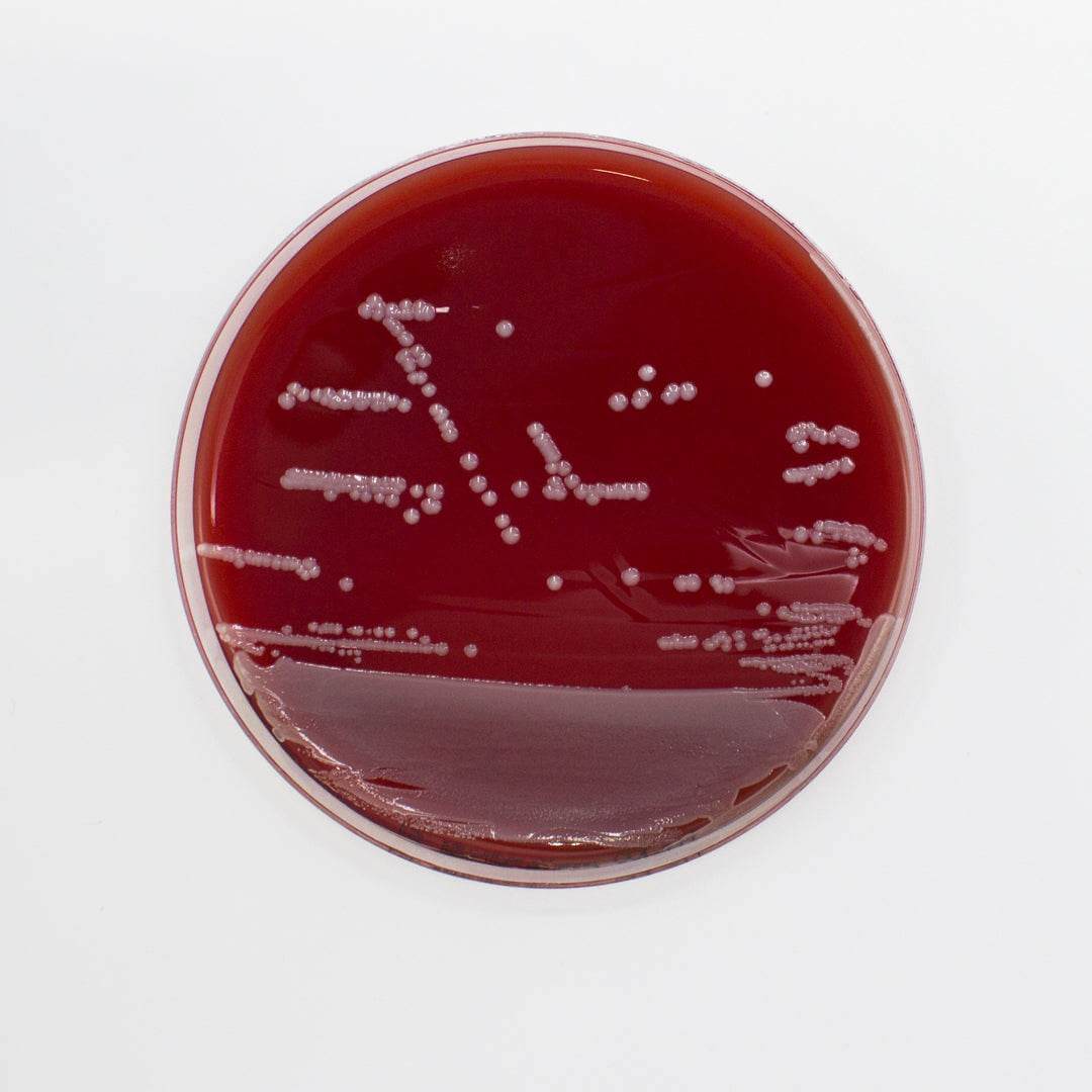 Columbia Agar (Horse Blood 5%) - Kormay Biomedicals store