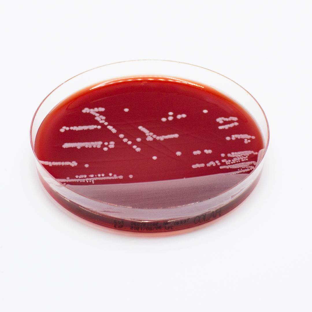 Columbia Agar (Horse Blood 5%) - Kormay Biomedicals store