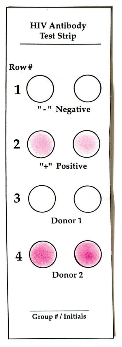 How Does a Doctor Test for AIDS? - Kormay Biomedicals store