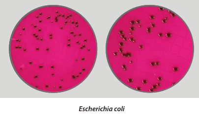 Easy Dry m-Endo LES - Kormay Biomedicals store