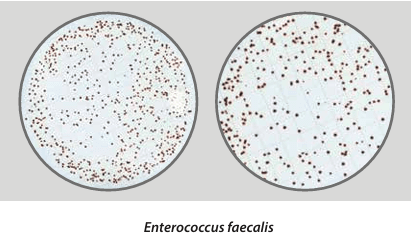 Easy Dry Streptococcal KF + TTC - Kormay Biomedicals store