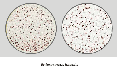 Easy Dry Slanetz Bartley - Kormay Biomedicals store