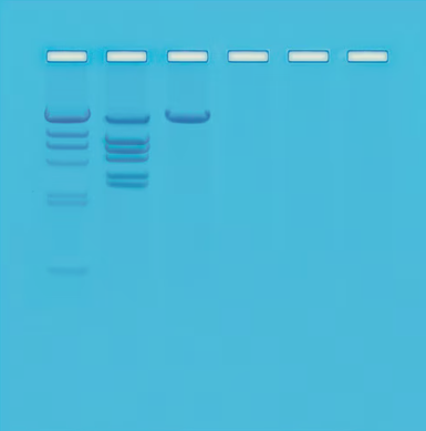 Investigation 9: Biotechnology - Restriction Enzyme Analysis of DNA Biotech Education Kit
