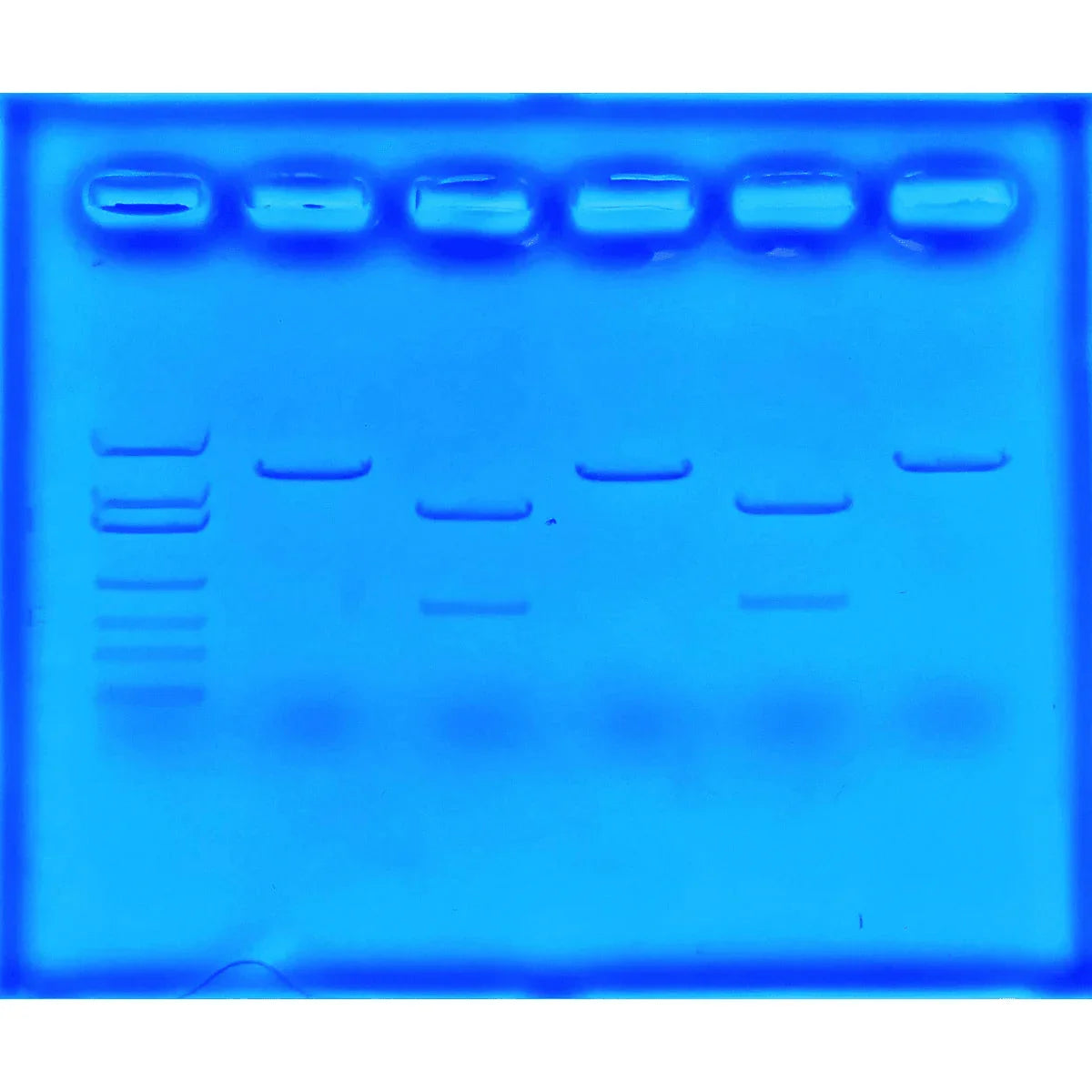 Using CRISPR to Treat Cystic Fibrosis - Kormay Biomedicals store