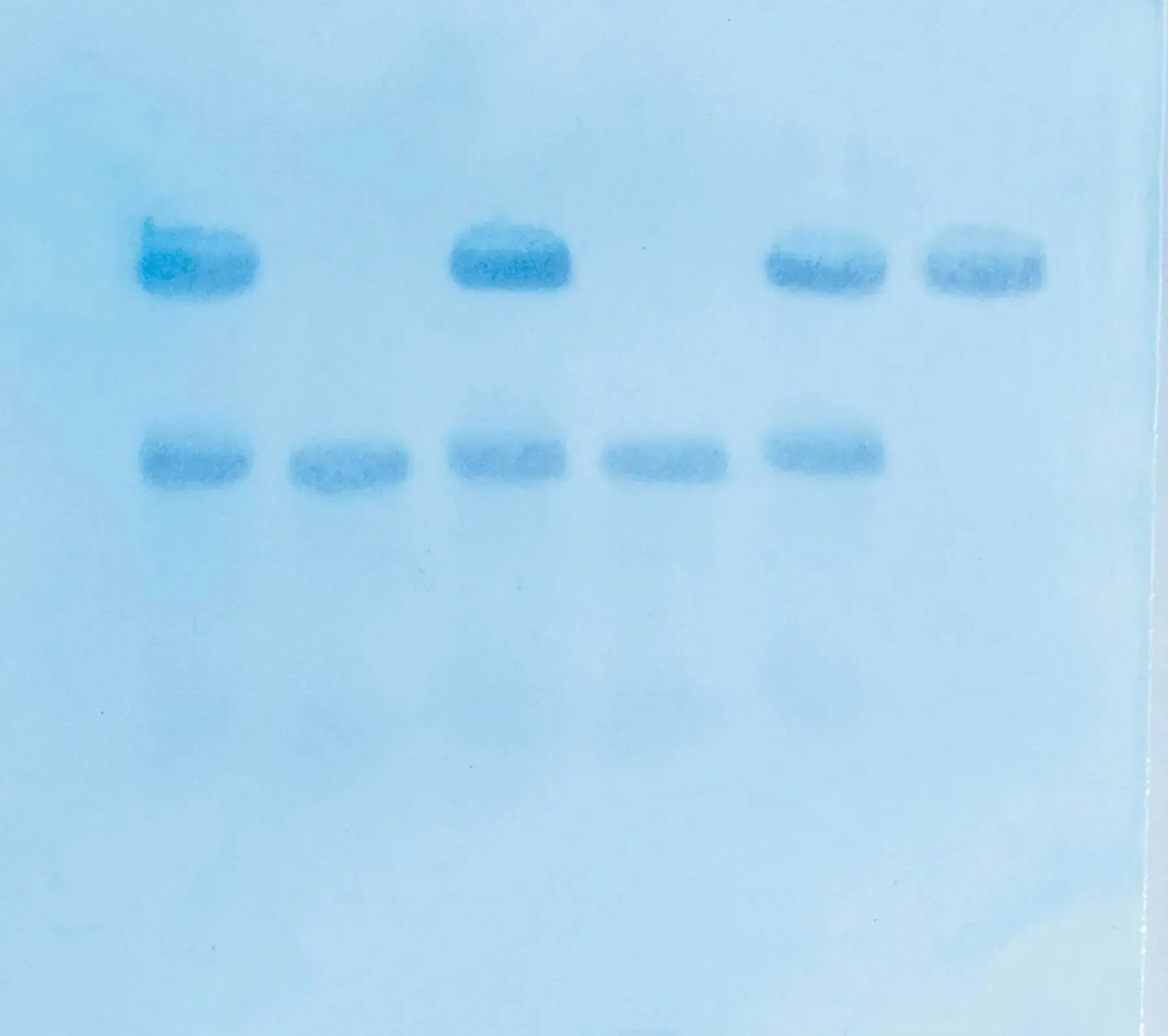 EDVOTEK Biotech Education UNIT In Search of the Sickle Cell Gene by Southern Blot