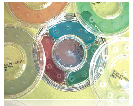 EASY RID h-IgA - 12 Test