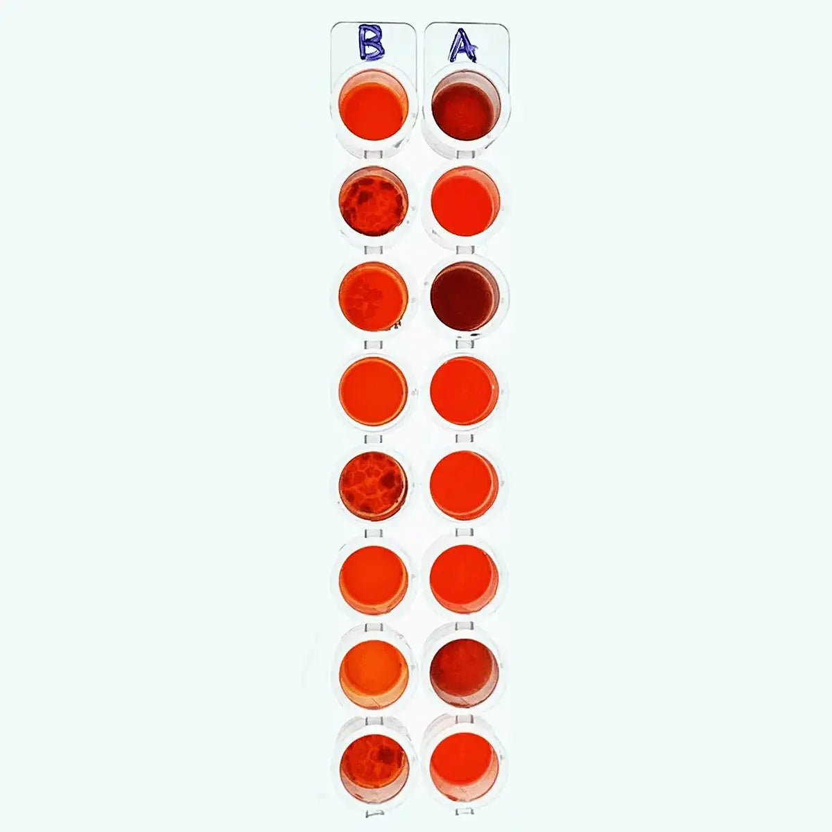 EDVOTEK Biotech Education UNIT Simulated ABO Blood Typing