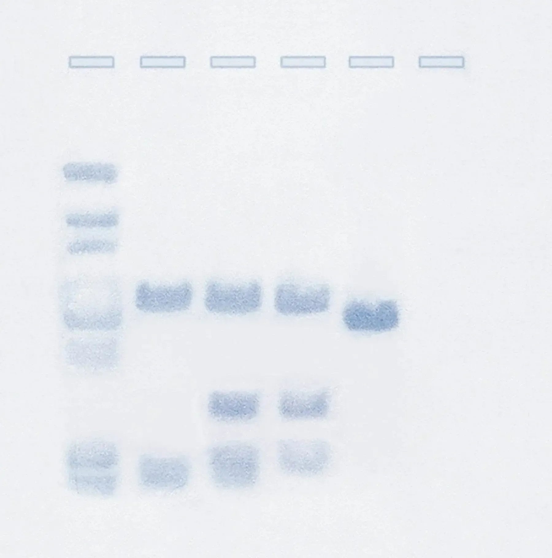 EDVOTEK Biotech Education UNIT Southern Blot Analysis