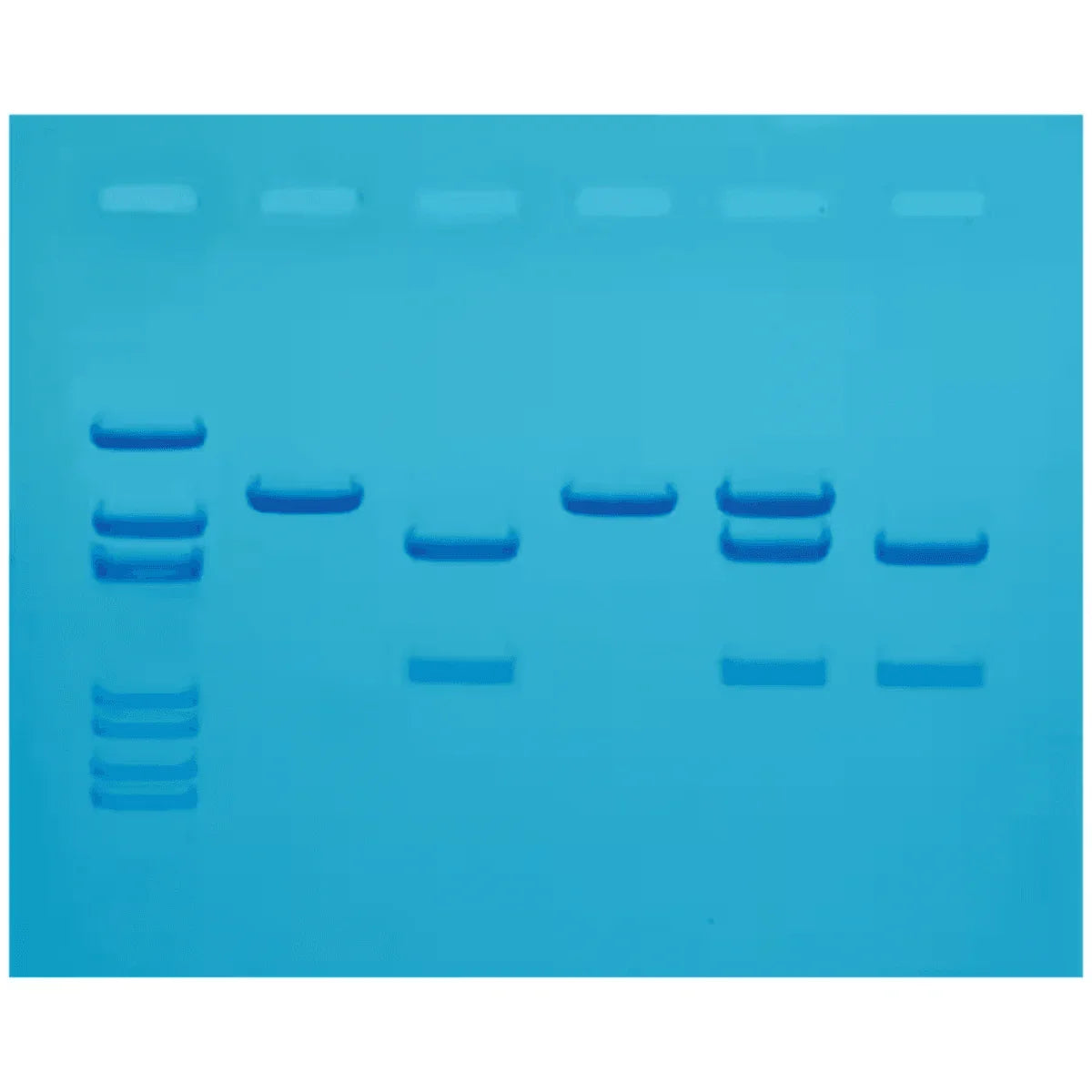 Cholesterol Diagnostics - Kormay Biomedicals store