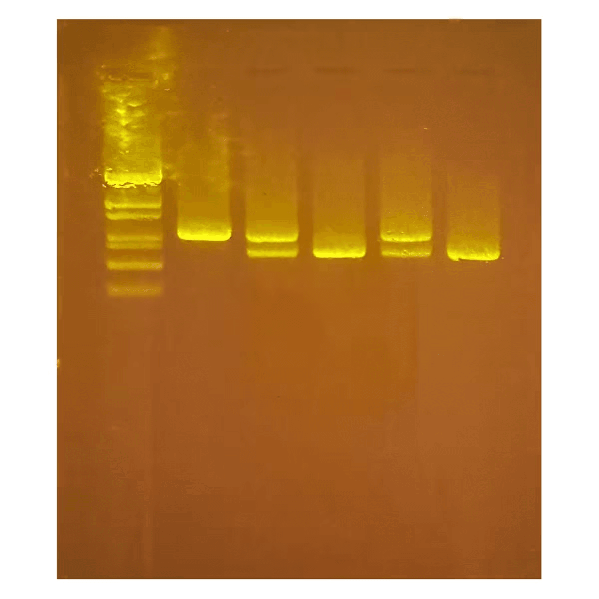 Diagnosing Huntington's Using PCR - Kormay Biomedicals store