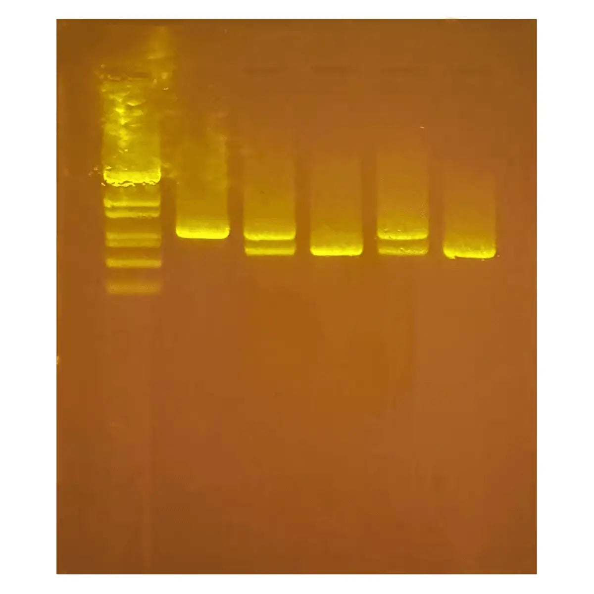 Diagnosing Huntington's Using PCR - Kormay Biomedicals store
