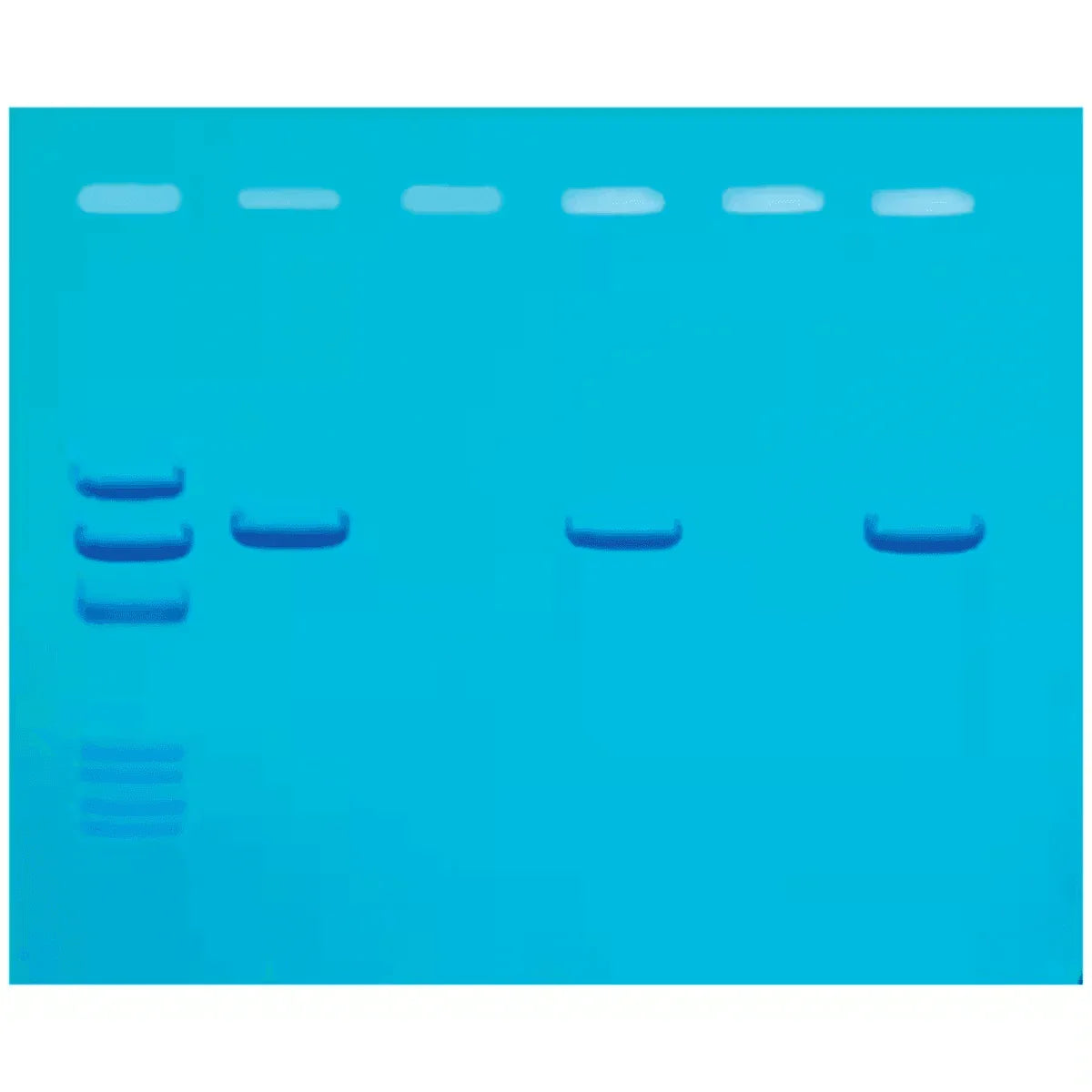 Detection of Mad Cow Disease - Kormay Biomedicals store