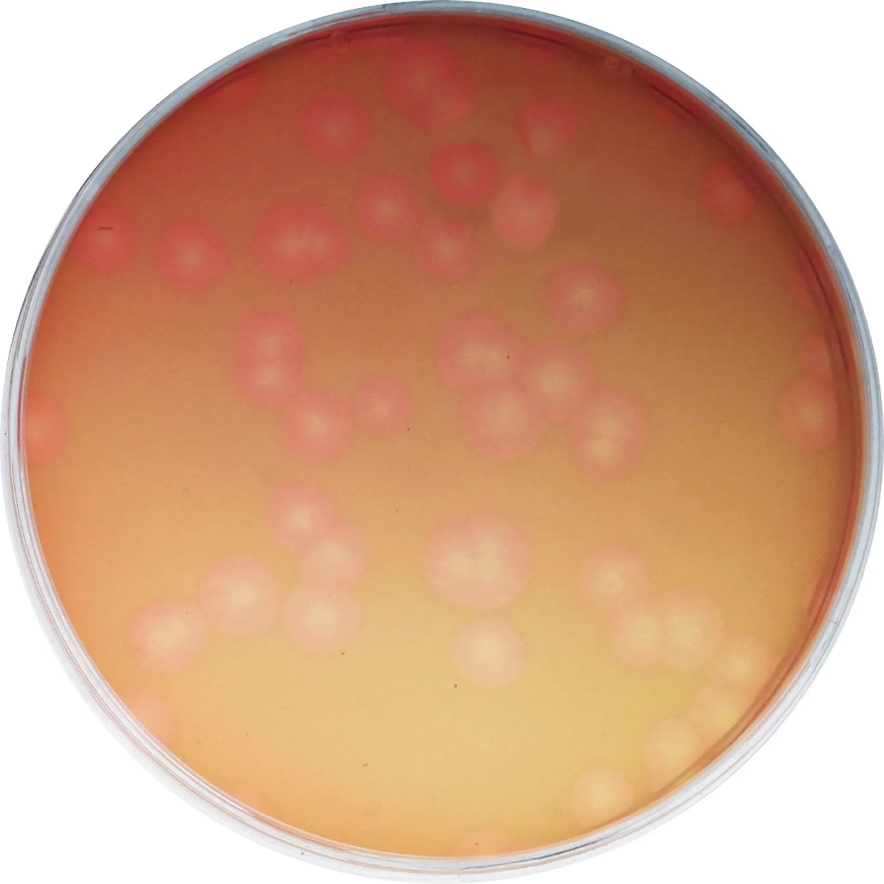 Going Un-Viral: Virus Quantification Using Plaque Assays - Kormay Biomedicals store