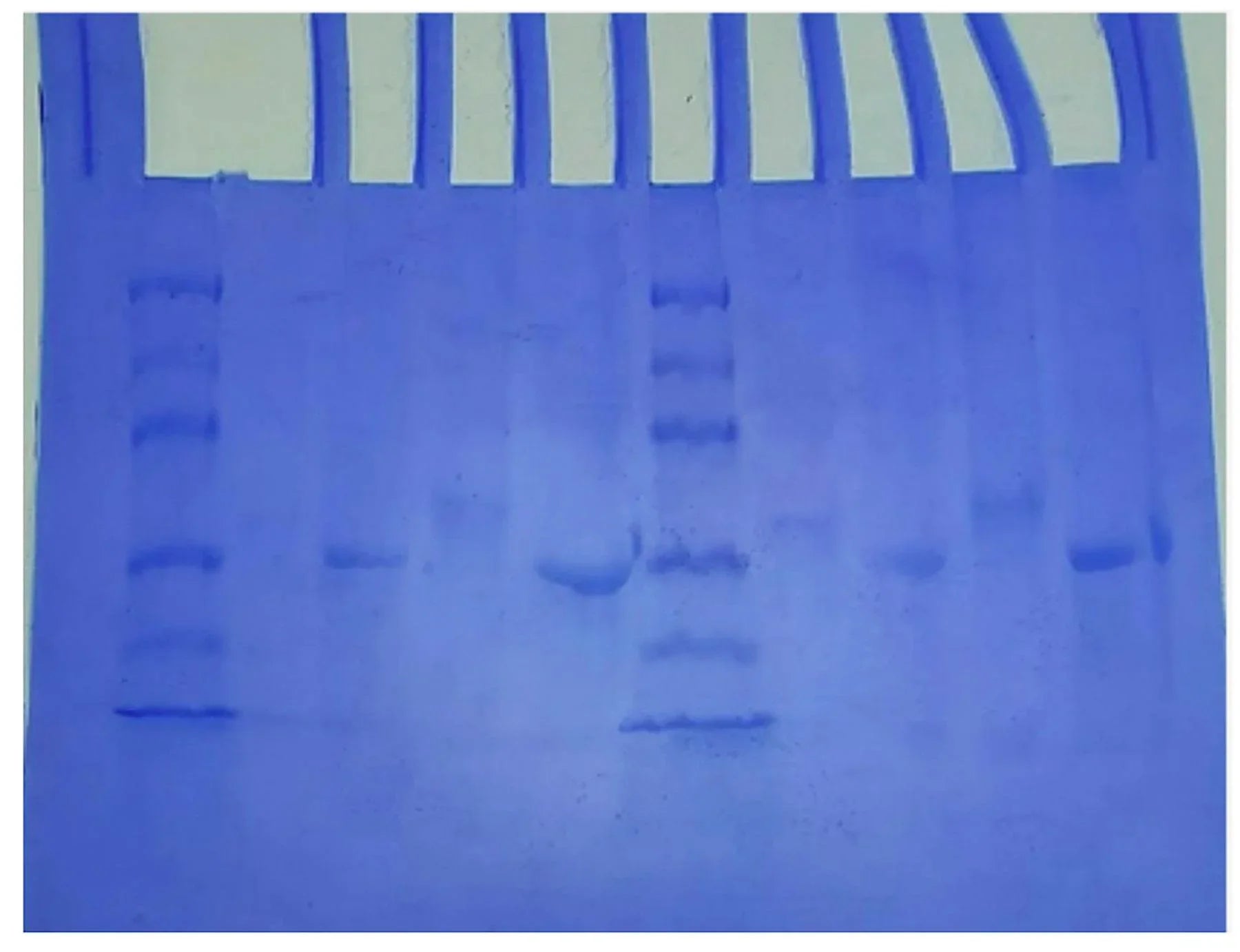 Purification & Size Determination of Green & Blue Fluorescent Proteins - Kormay Biomedicals store