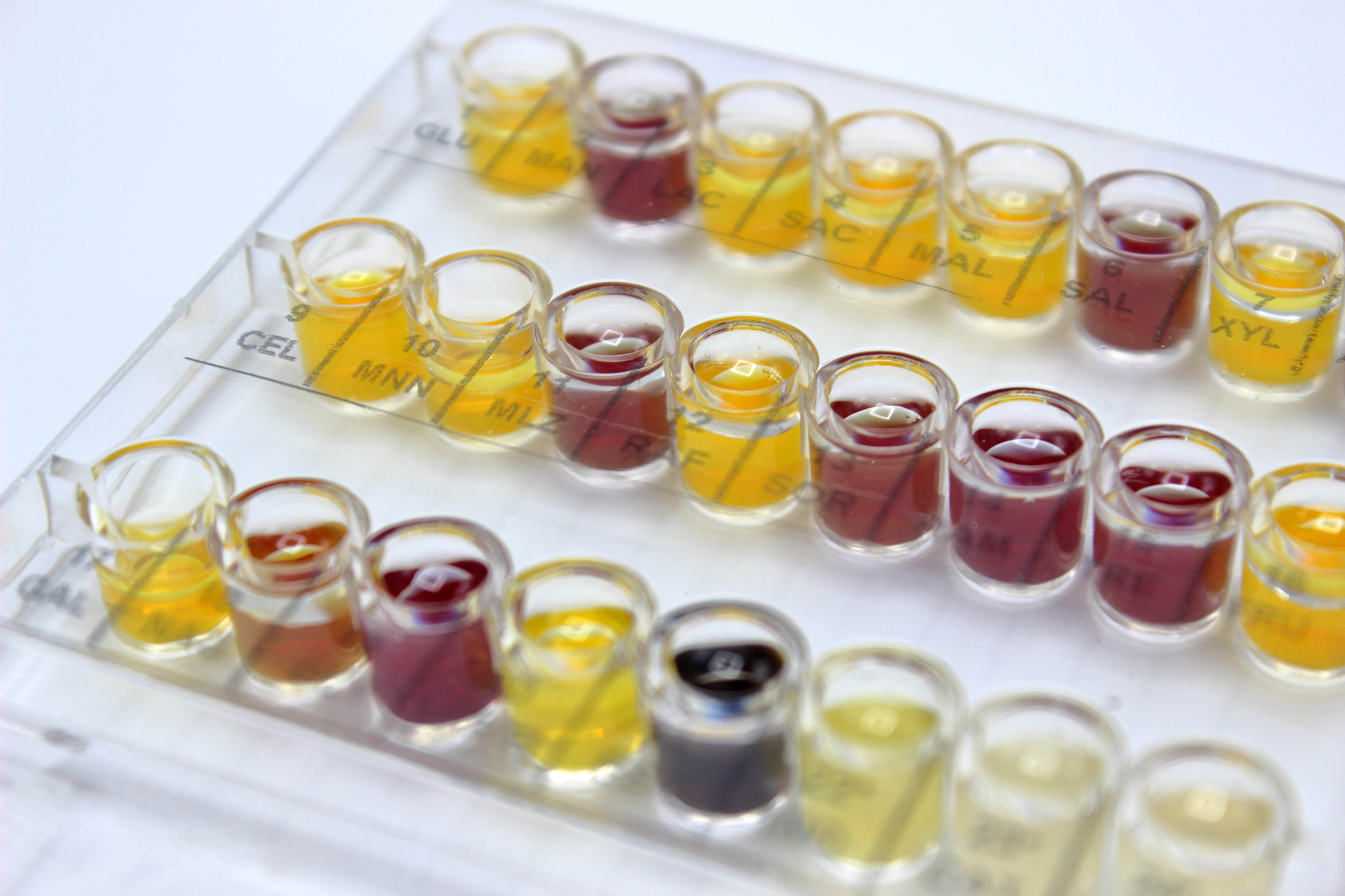 Anaerobe System - Kormay Biomedicals store