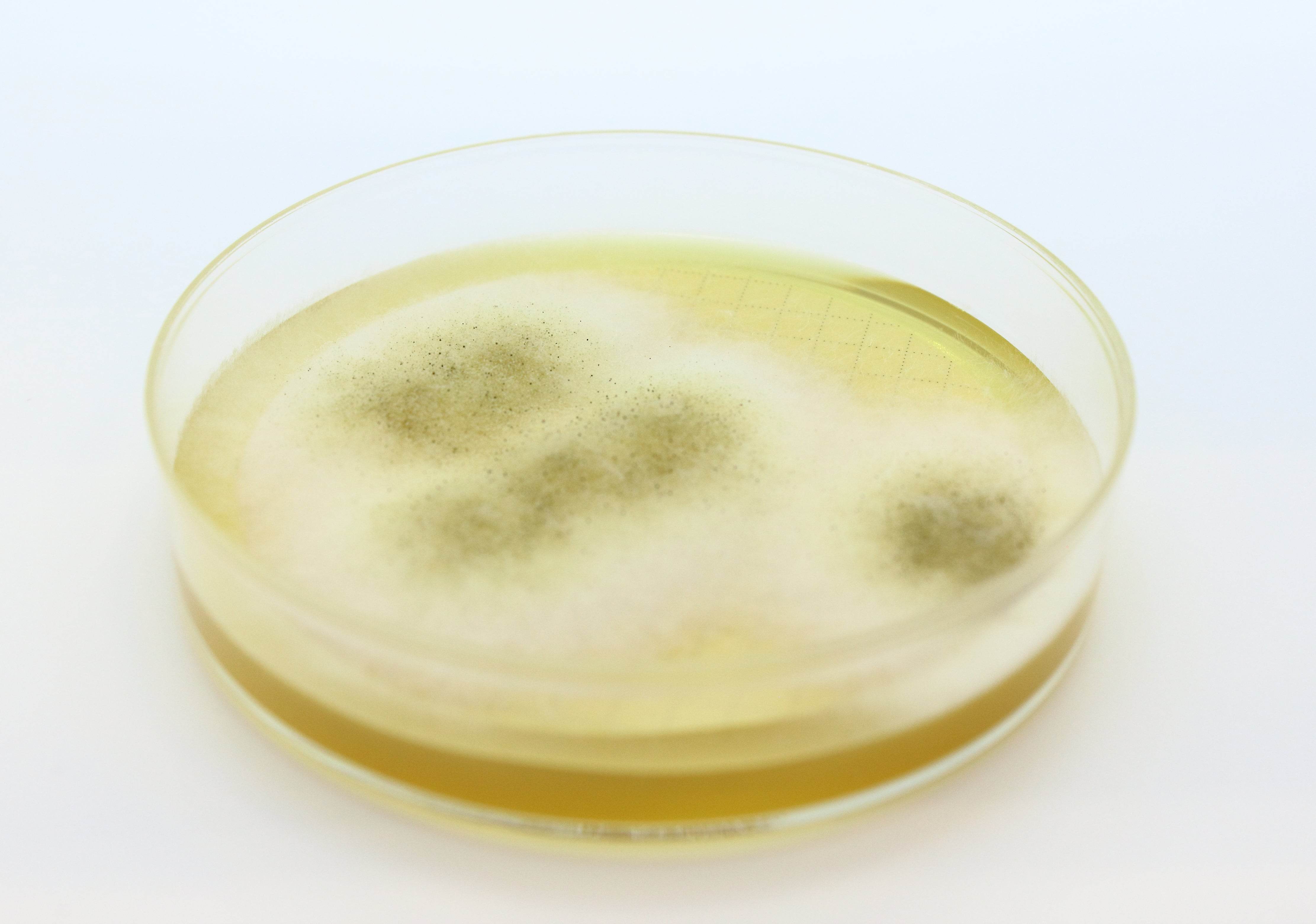 Easy Dry M-Green Yeast & Mold - Kormay Biomedicals store