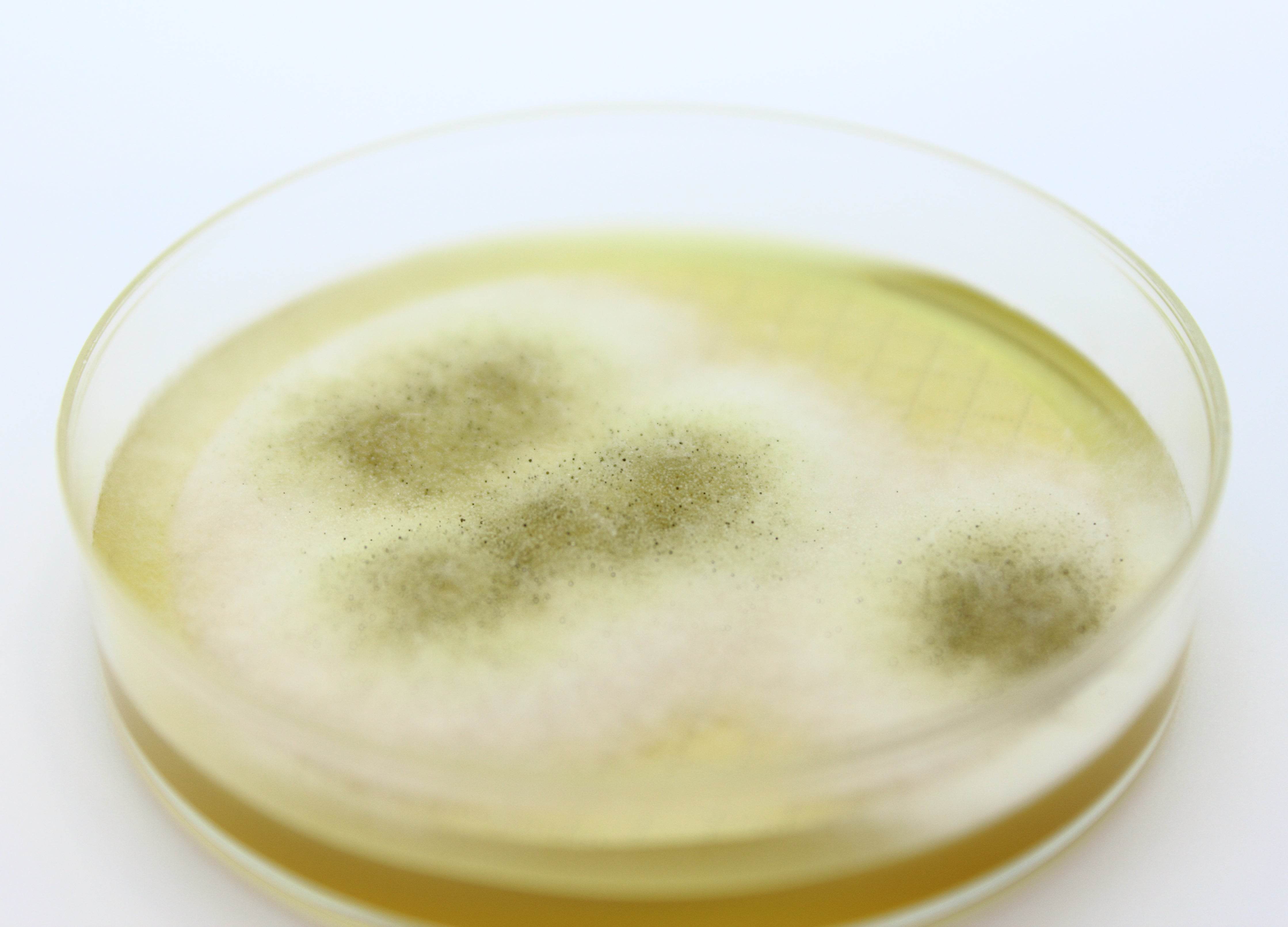 Easy Dry M-Green Yeast & Mold - Kormay Biomedicals store