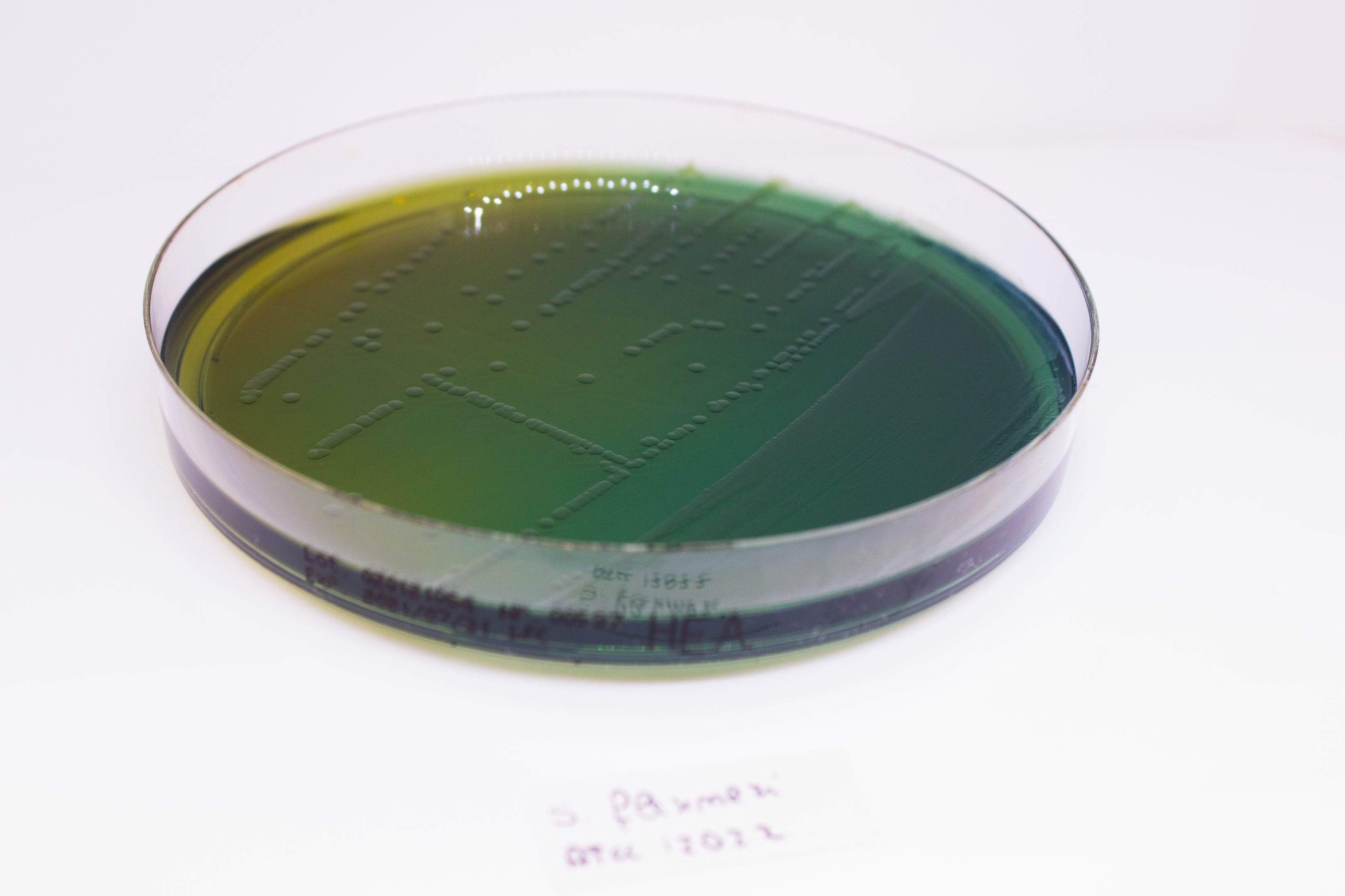 Hektoen Enteric Agar - Kormay Biomedicals store