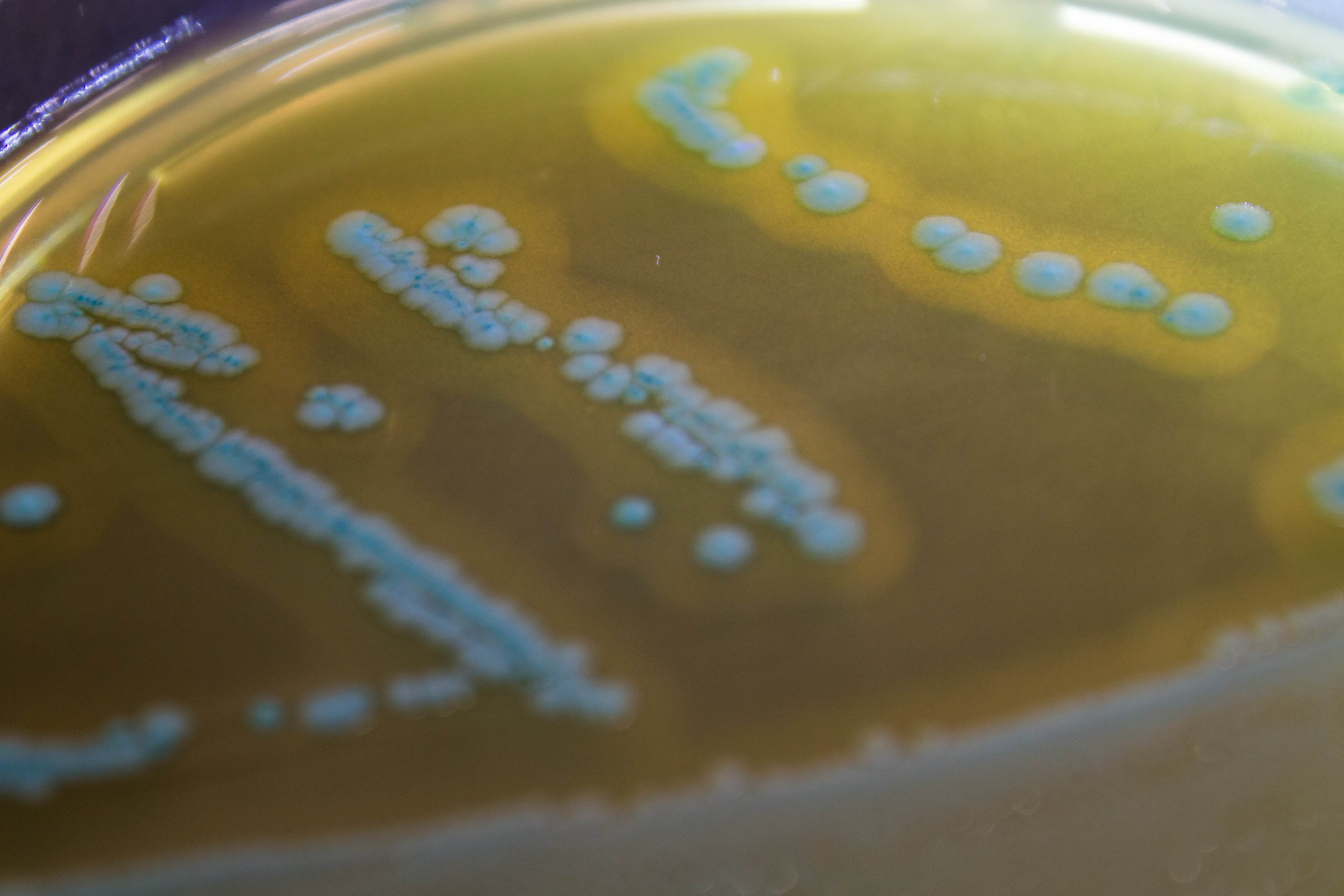 O.A. Listeria Agar - Kormay Biomedicals store