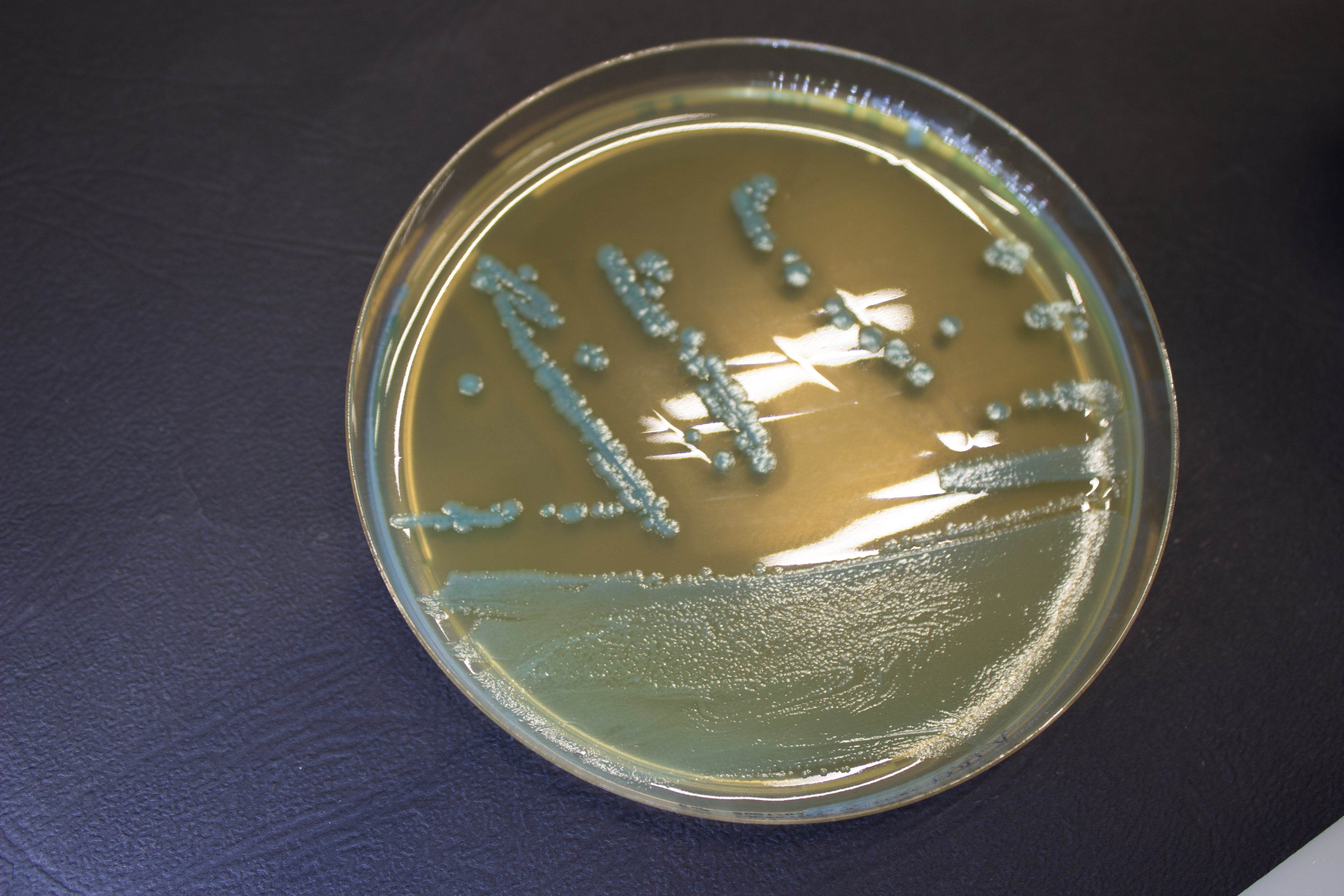 O.A. Listeria Agar - Kormay Biomedicals store