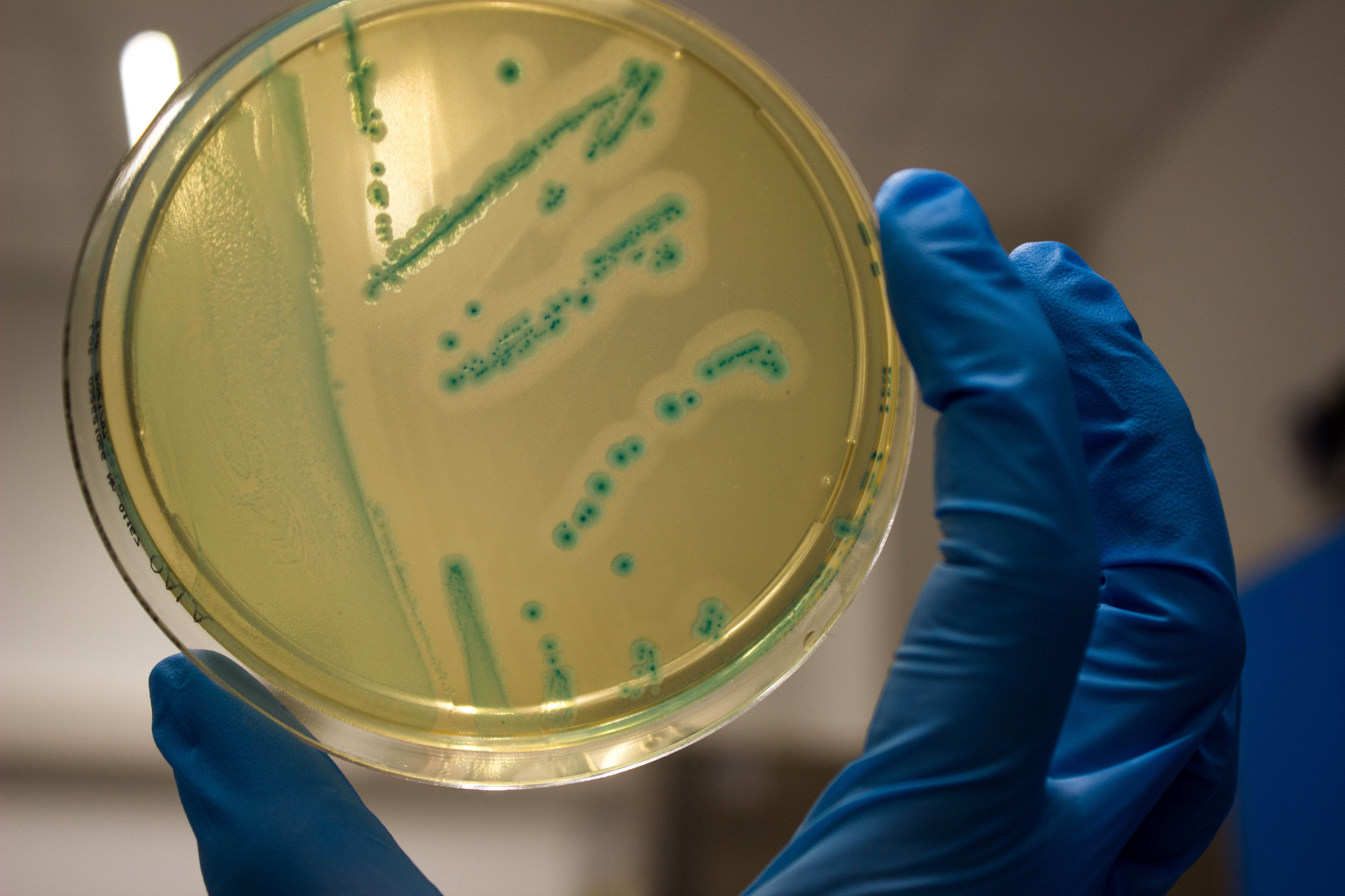 O.A. Listeria Agar - Kormay Biomedicals store