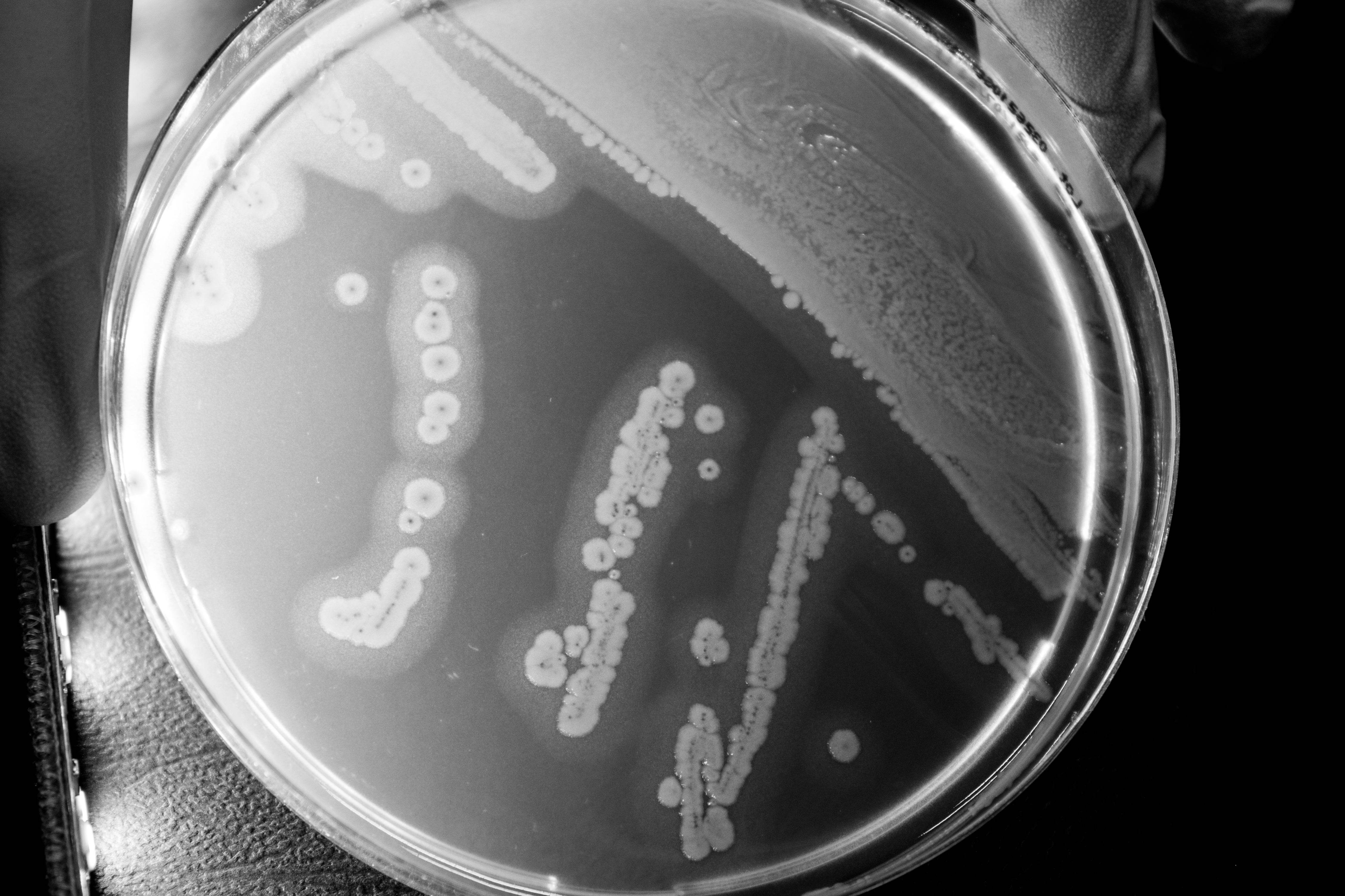 O.A. Listeria Agar - Kormay Biomedicals store