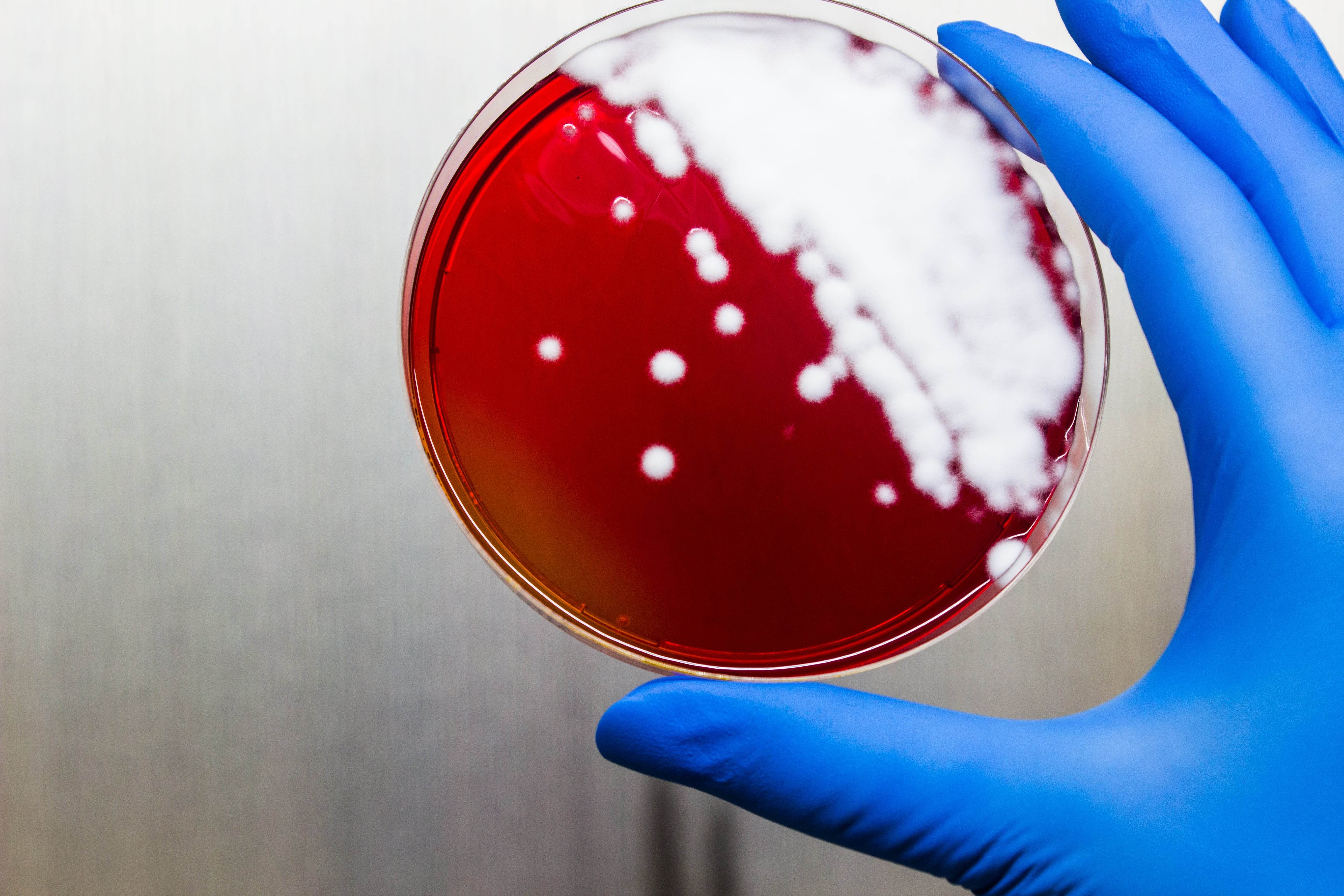 DERMATOPHYTE (D.T.M.) Agar - Kormay Biomedicals store